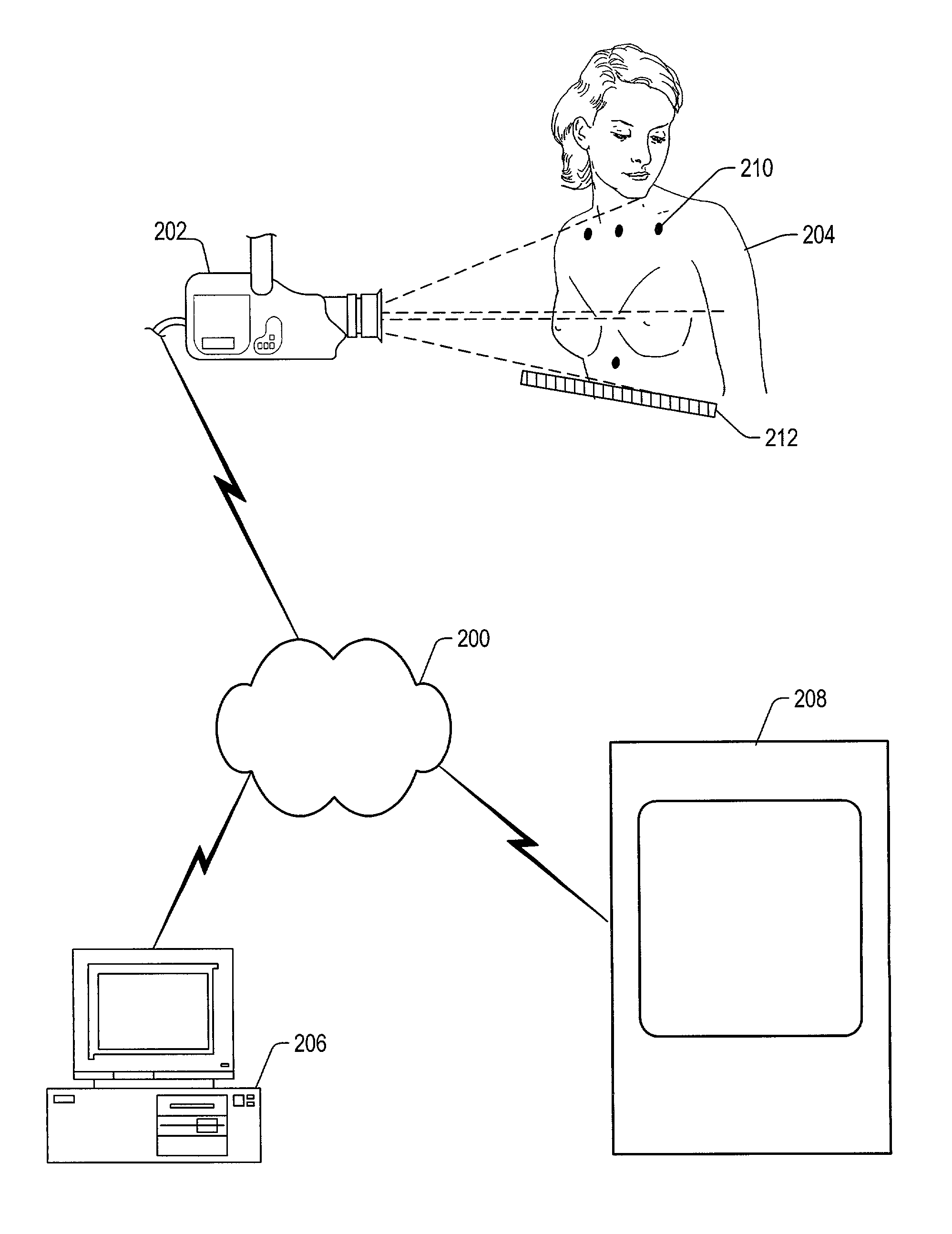 Methods of forming prostheses