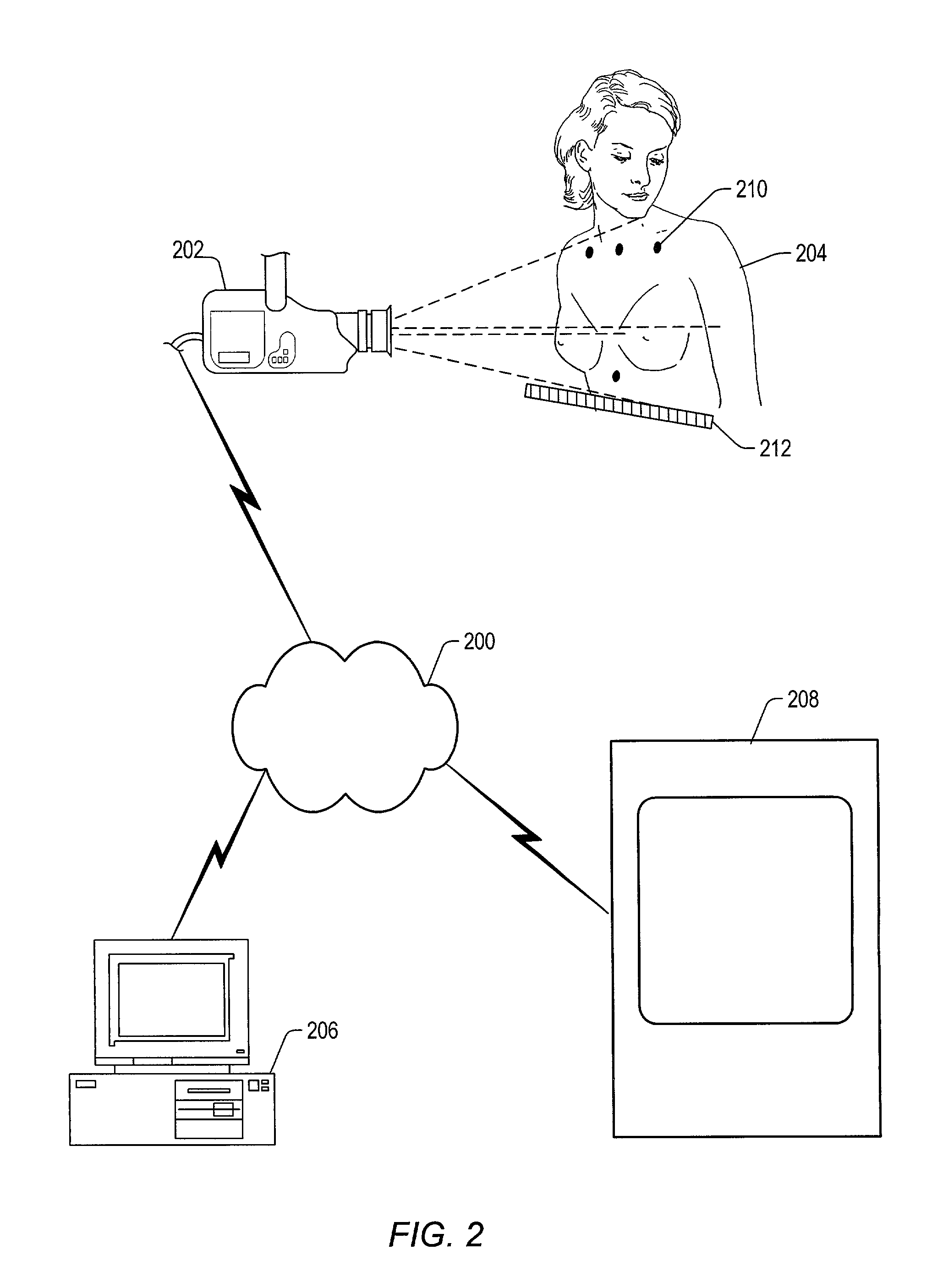 Methods of forming prostheses