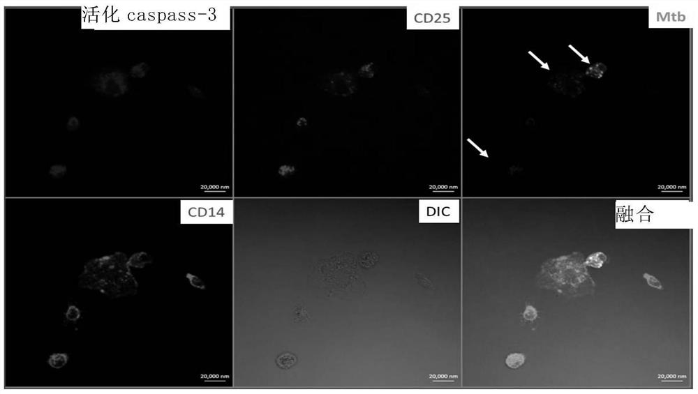 A kind of fusion protein and its use for treating diseases