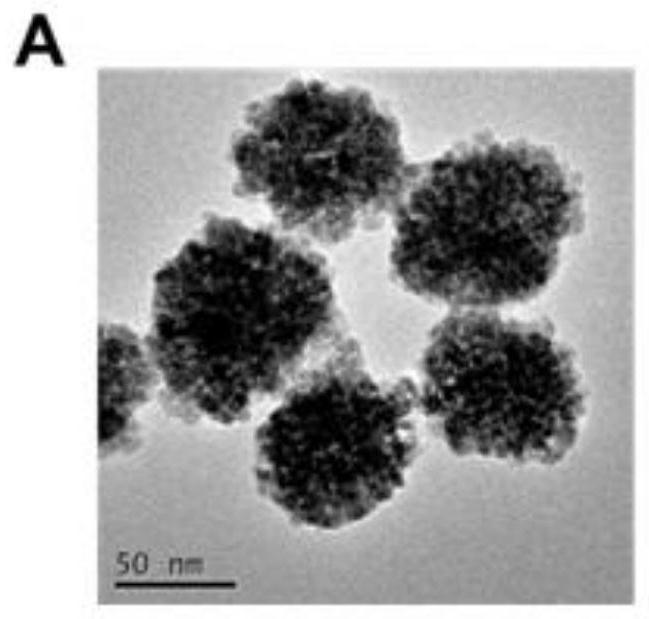 Brain-targeted drug delivery system with ferroptosis and immune activation cascade amplification effect