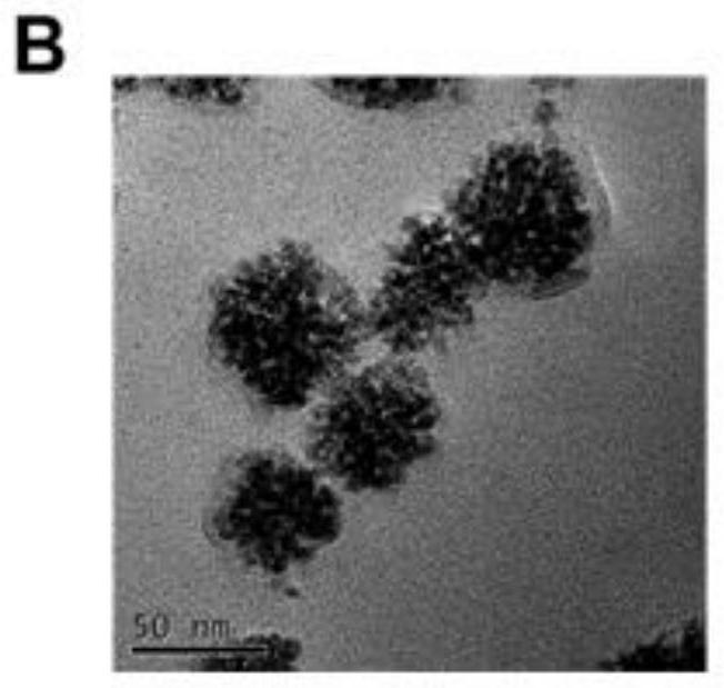 Brain-targeted drug delivery system with ferroptosis and immune activation cascade amplification effect