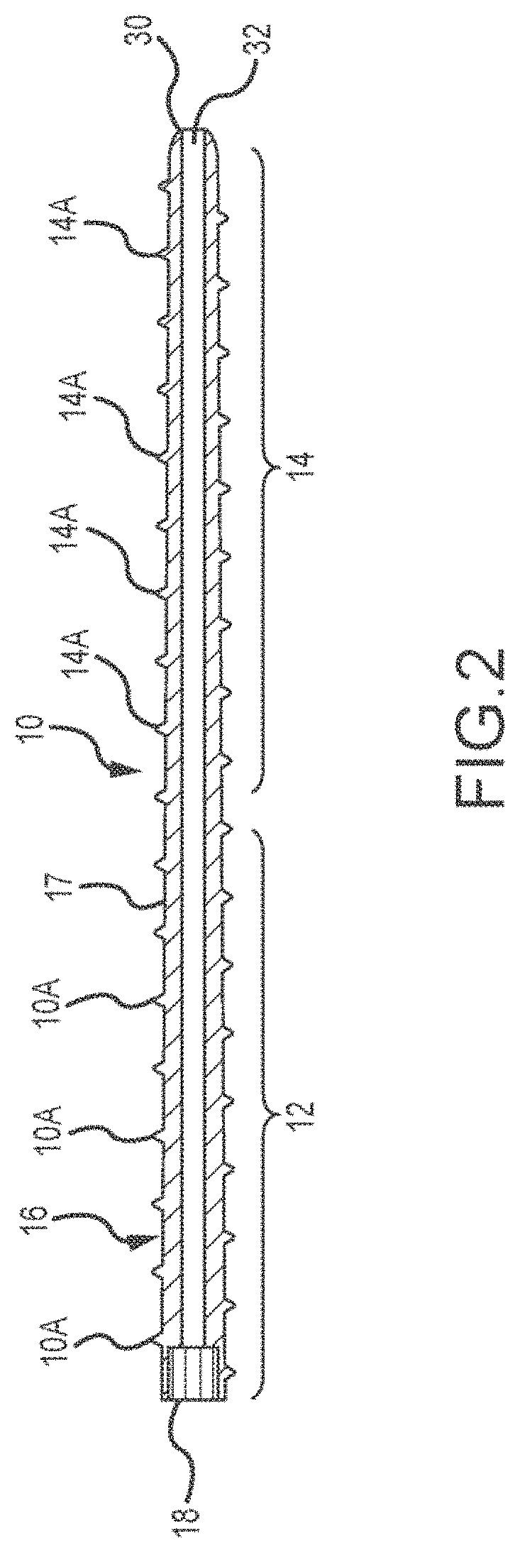 Bone stabilization device