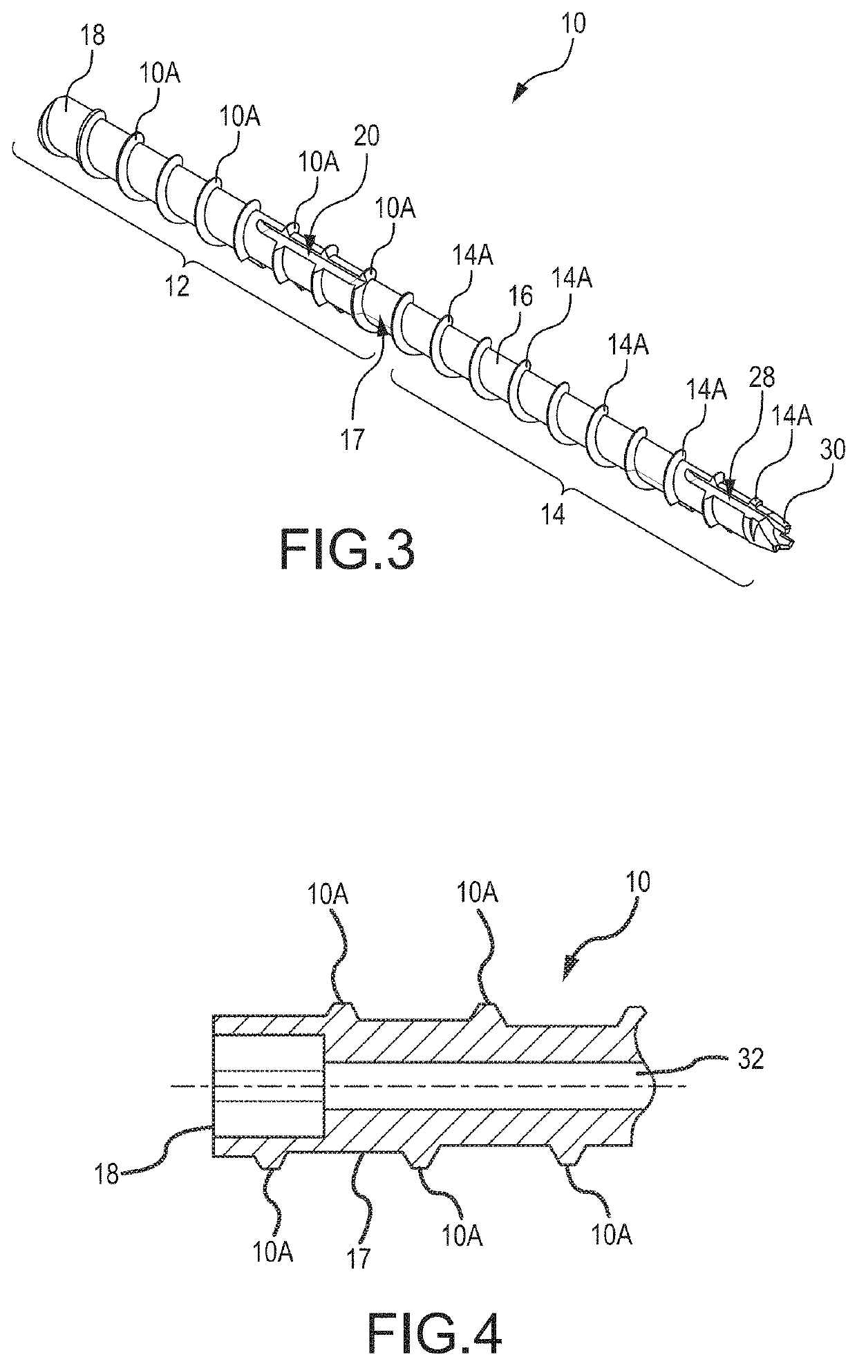 Bone stabilization device