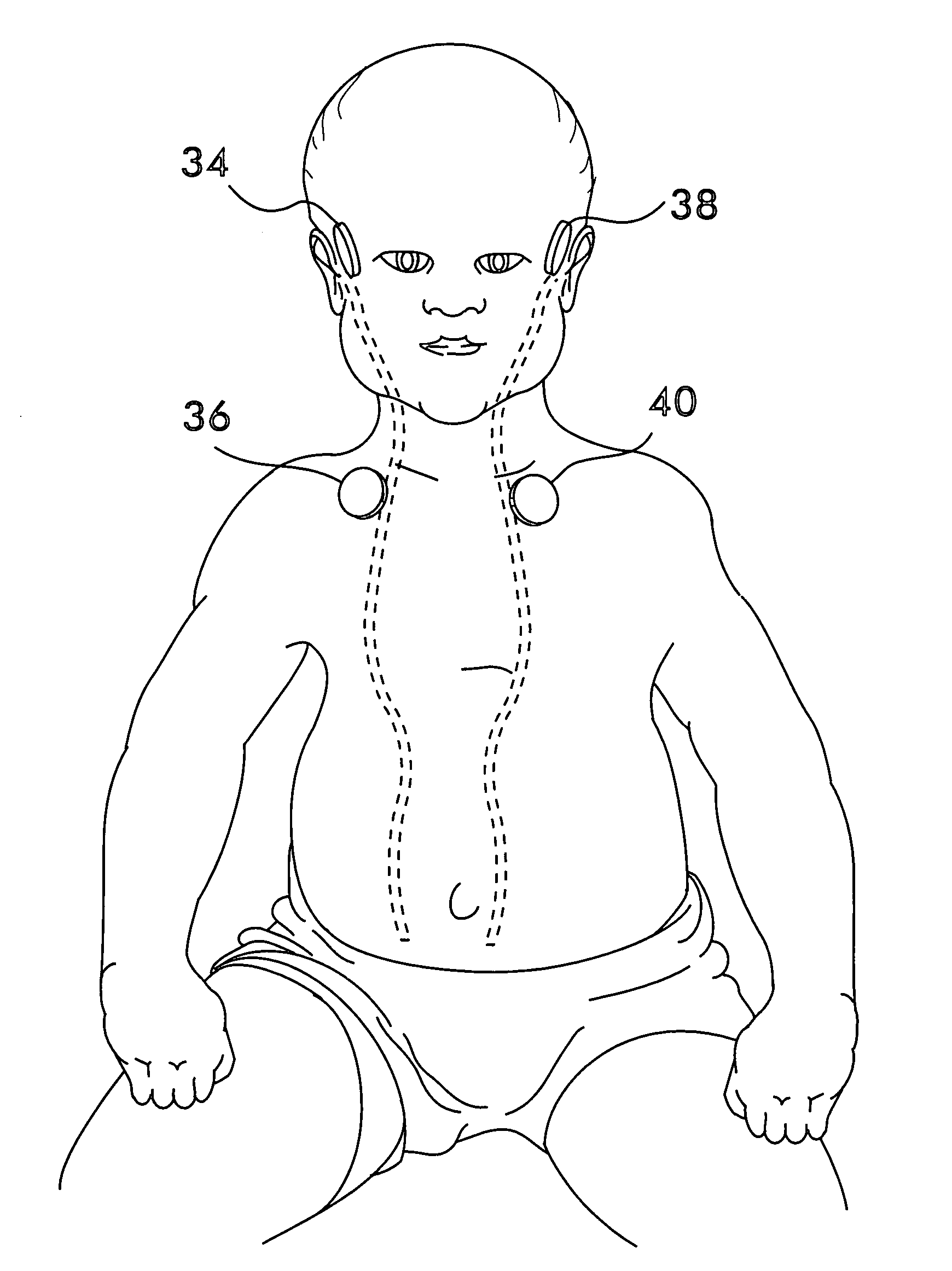 Cerebral spinal fluid shunt evaluation system