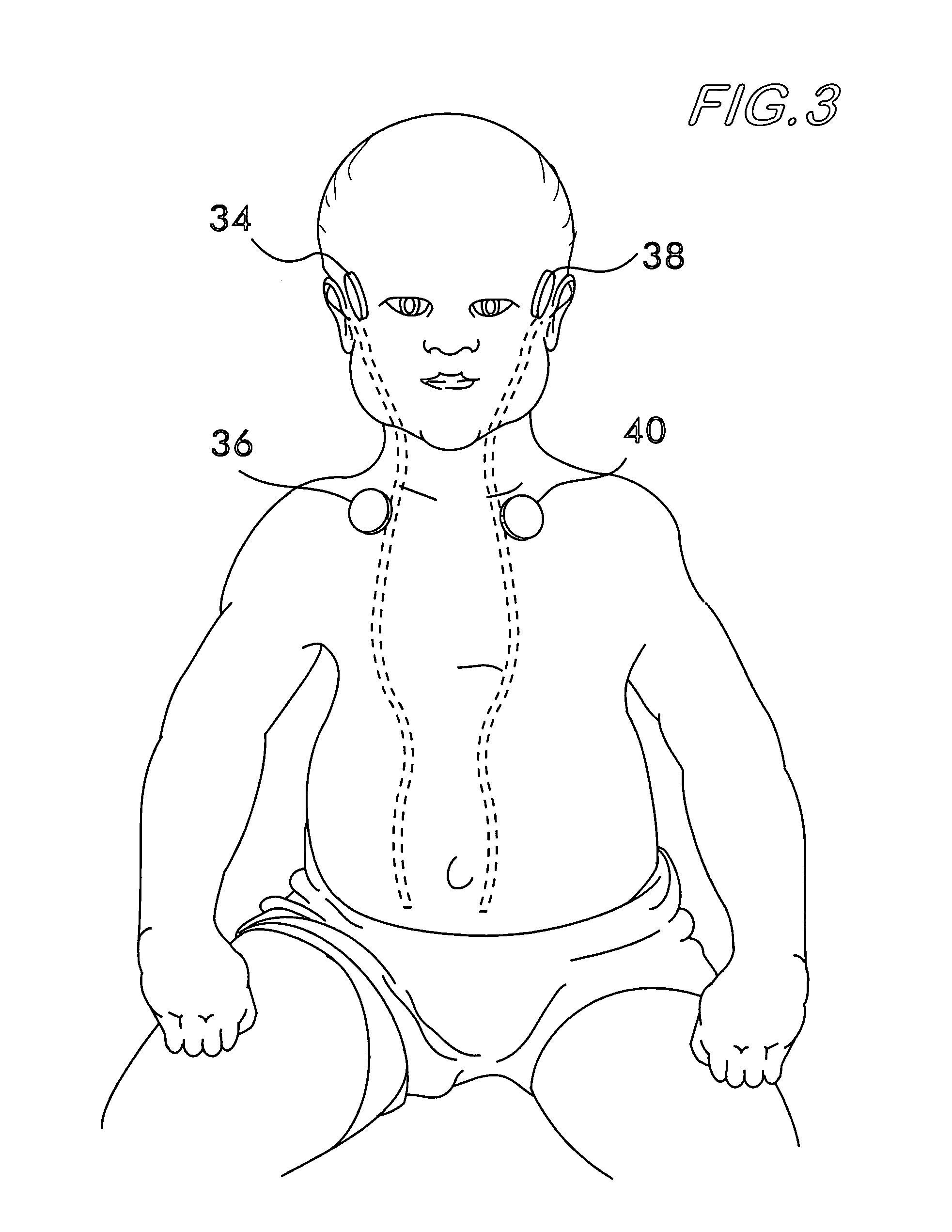 Cerebral spinal fluid shunt evaluation system