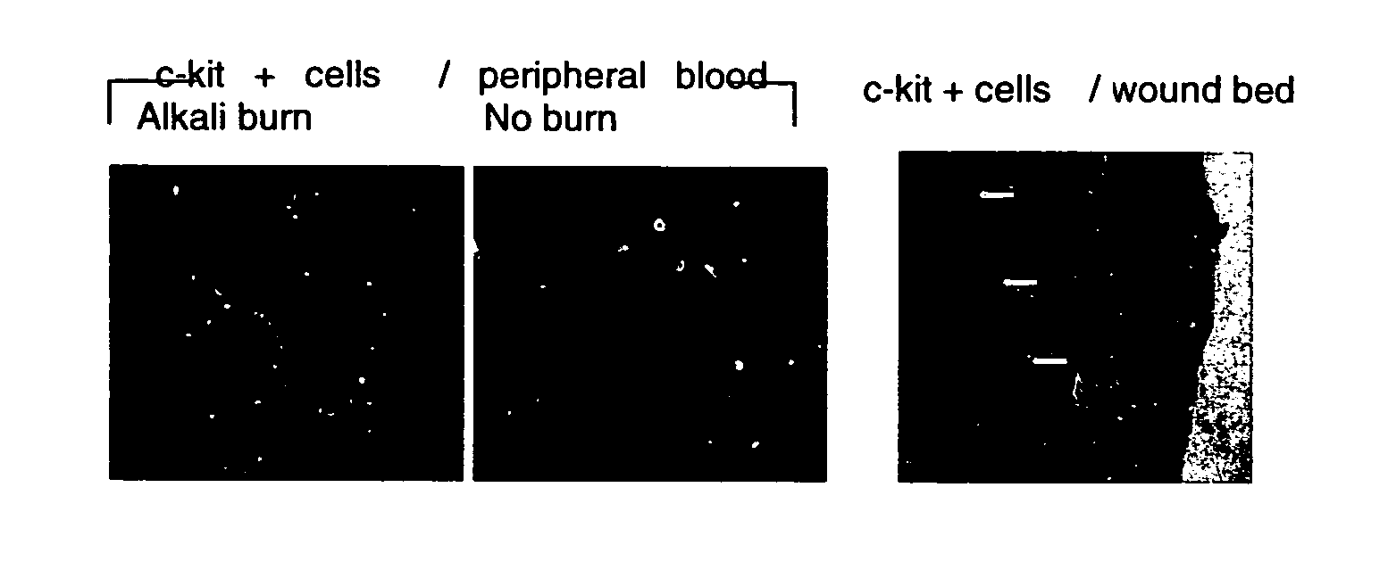 Use of substance P for mobilization of Mesenchymal stem cells or proliferation of Mesenchymal stem cells and for wound healing or facilitating wound healing