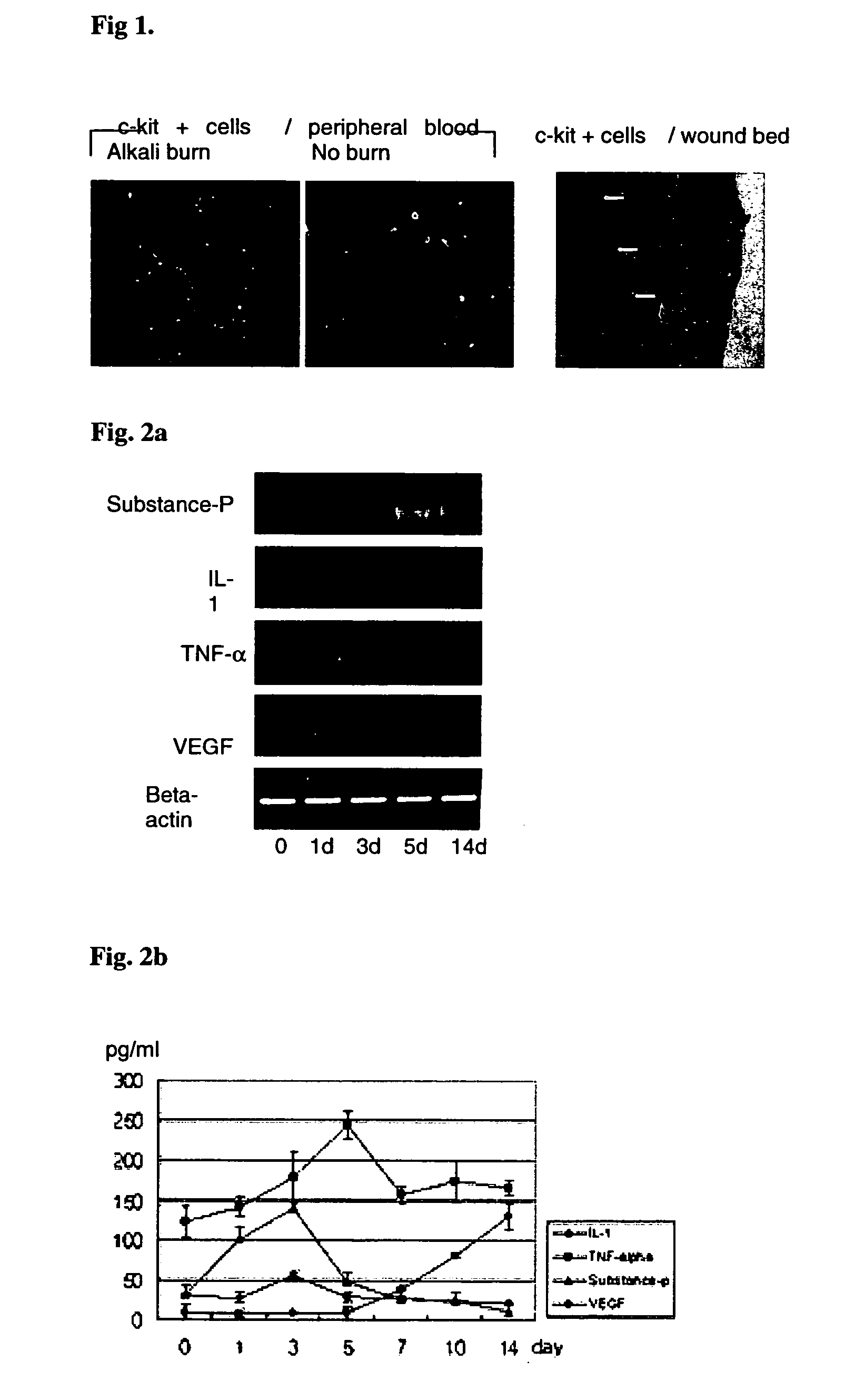 Use of substance P for mobilization of Mesenchymal stem cells or proliferation of Mesenchymal stem cells and for wound healing or facilitating wound healing