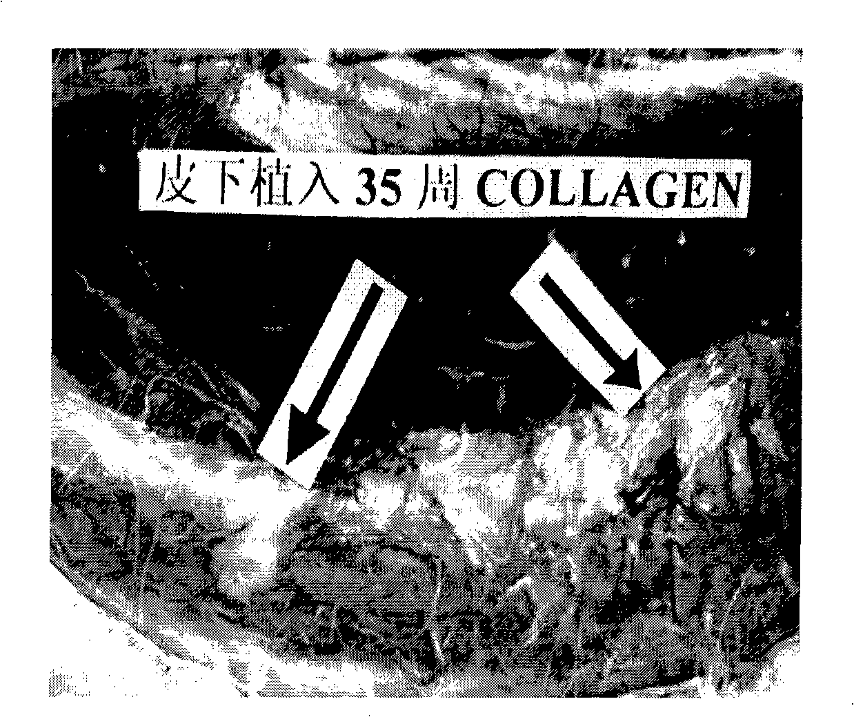 Medical grade reconstructed collagen cross-linking modified method