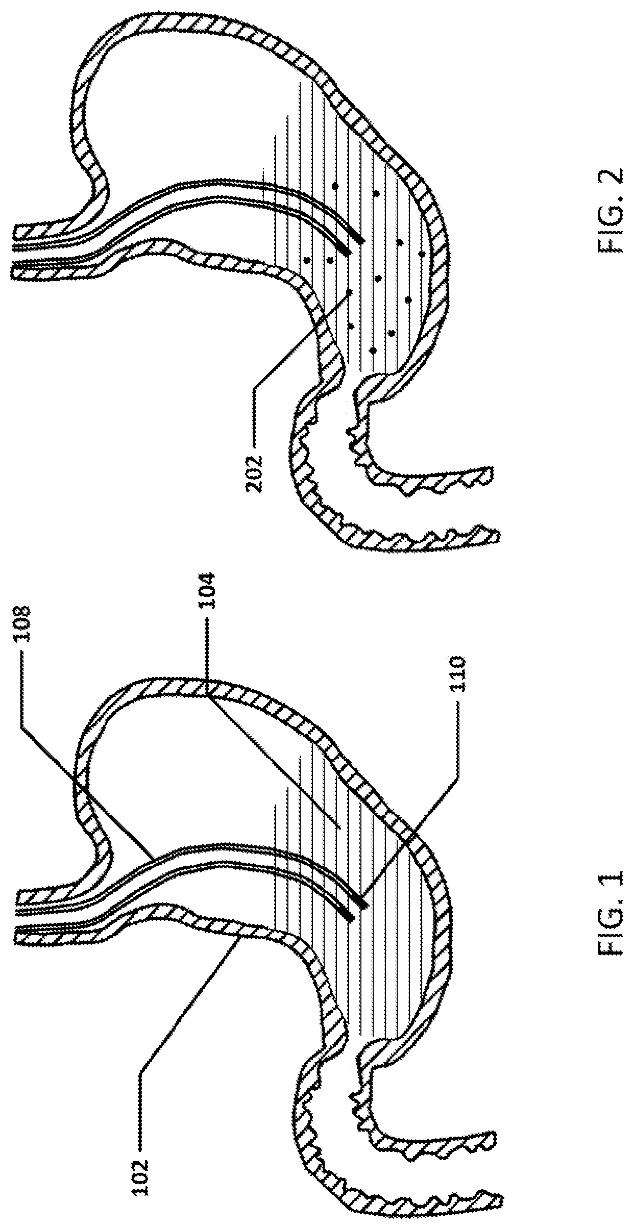 Devices and methods to measure gastric residual volume