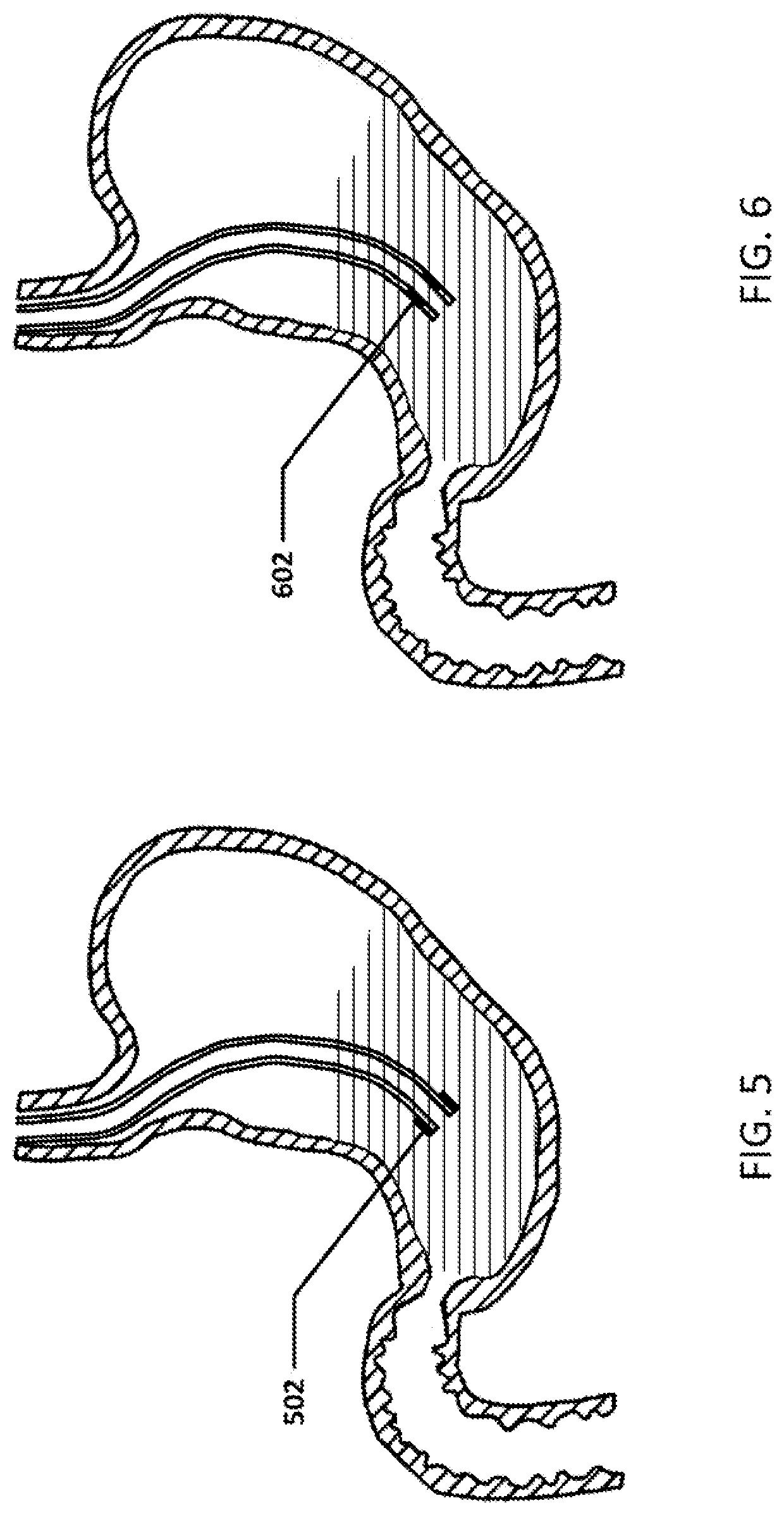 Devices and methods to measure gastric residual volume