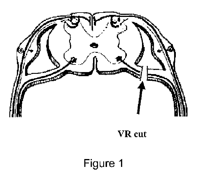 Effects of sporoderm-broken germination activated ganoderma spores on treatment of spinal cord injury