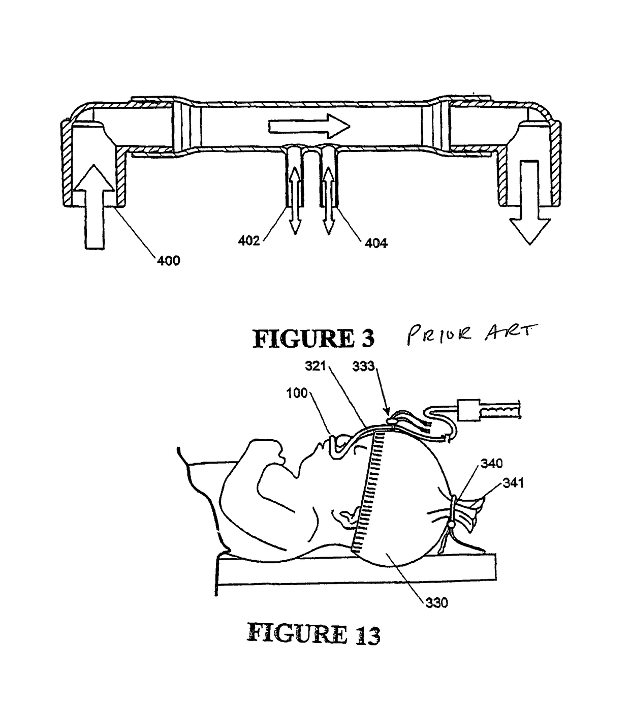 Breathing assistance apparatus