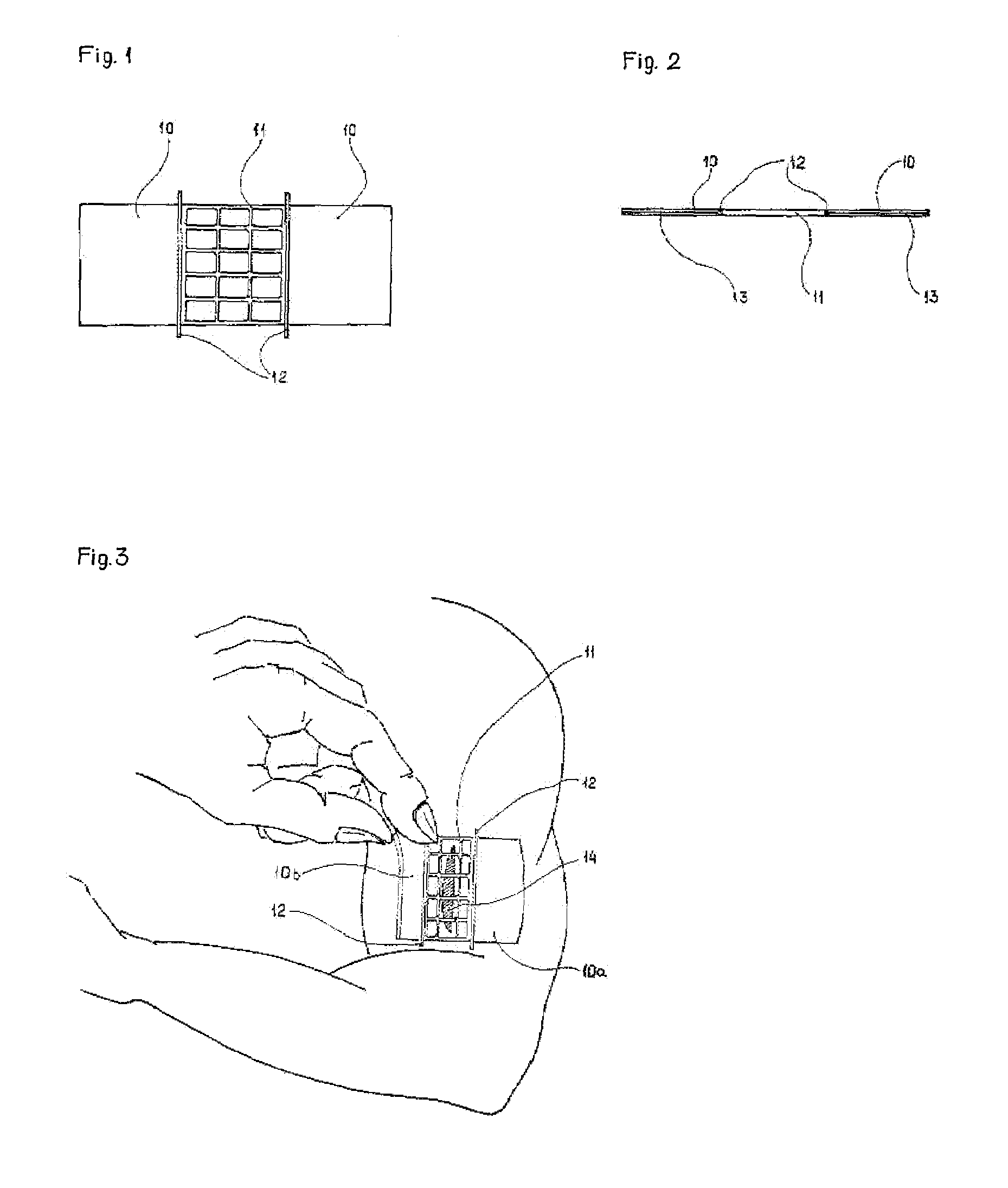 Surgical bandage and methods for treating open wounds