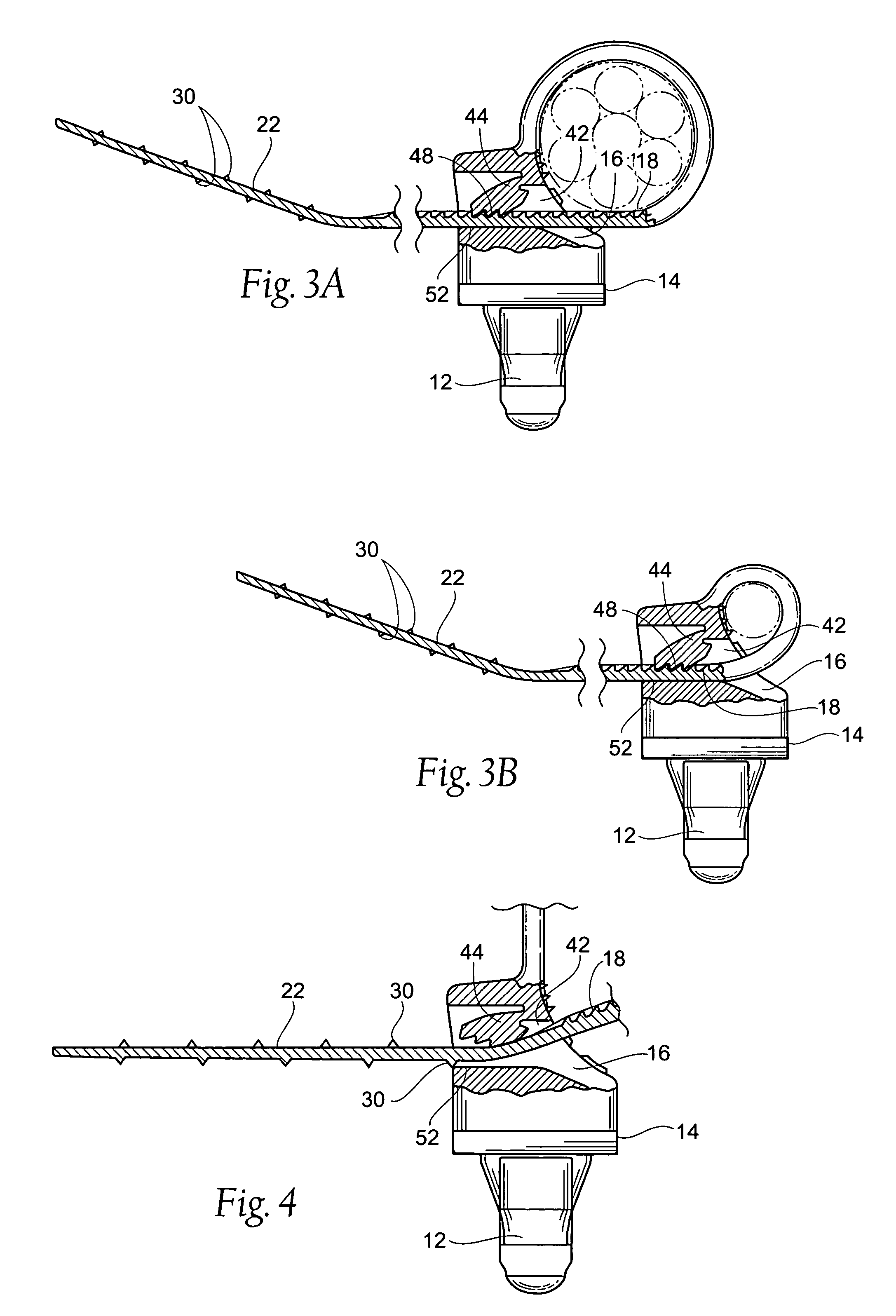 Harness clamp tie