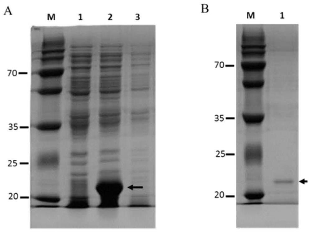 A Schistosoma japonicum immune epitope recombinant protein and its application