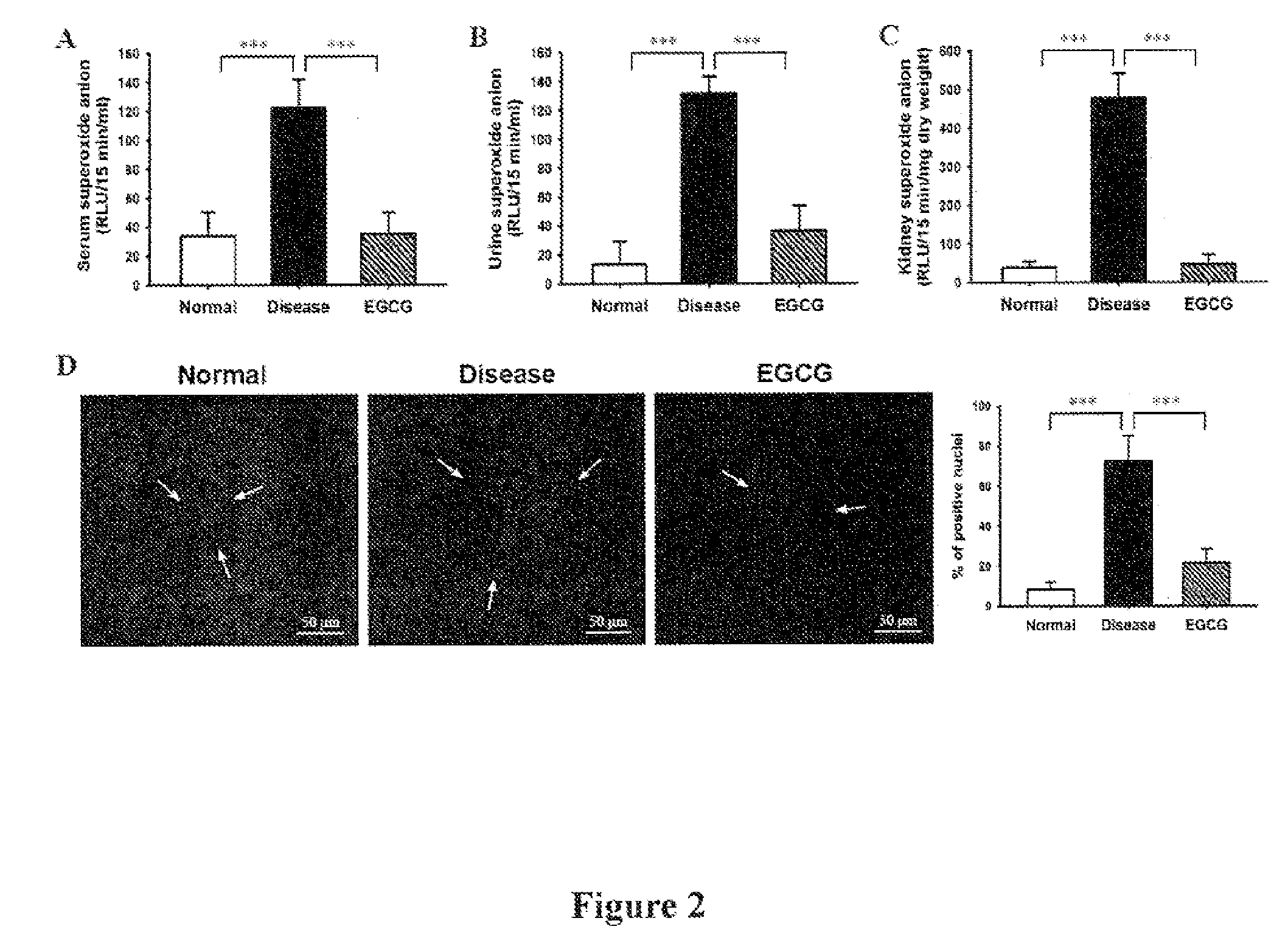 Use of epigallocatechin-3-gallate for immune regulation