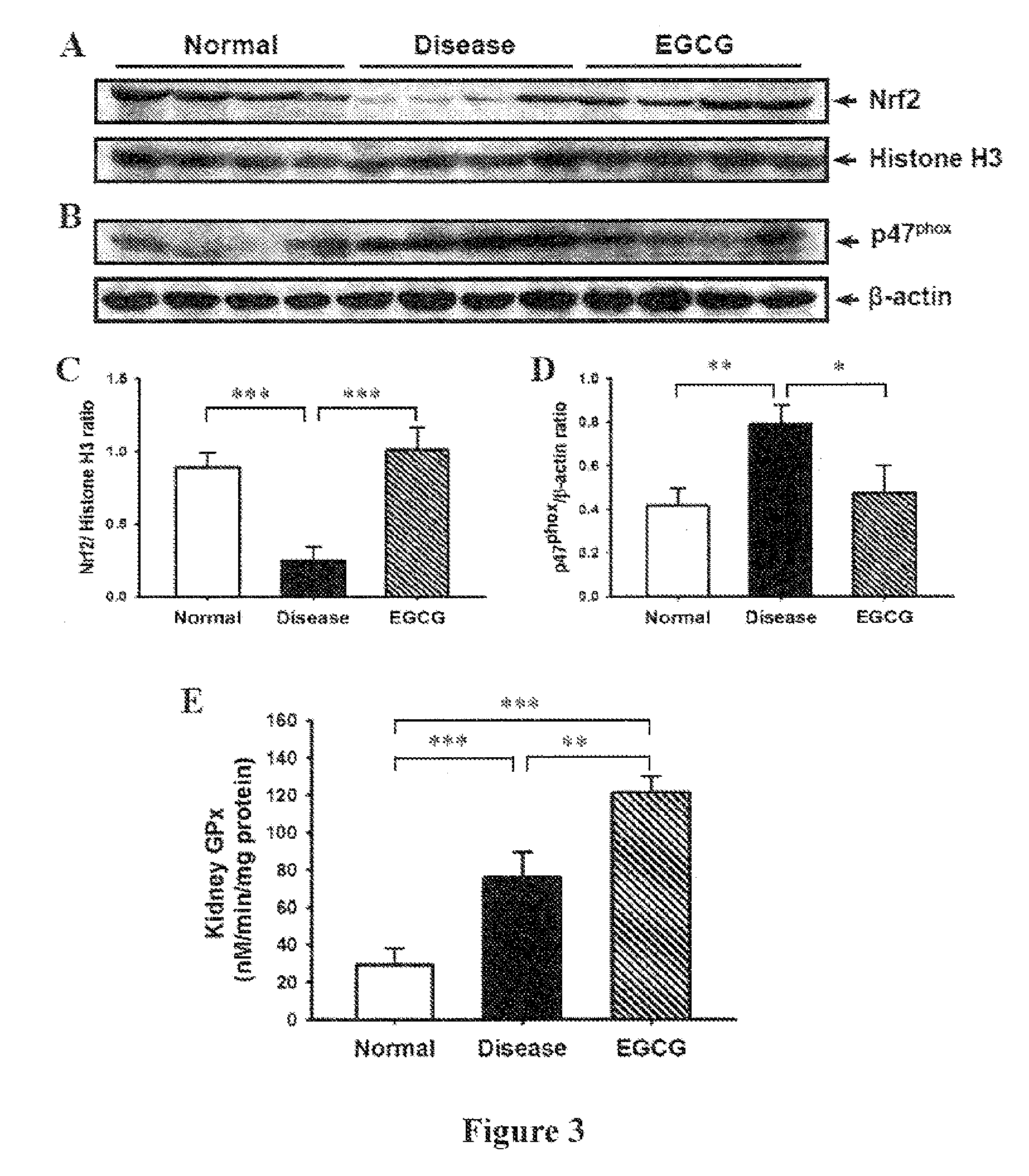 Use of epigallocatechin-3-gallate for immune regulation