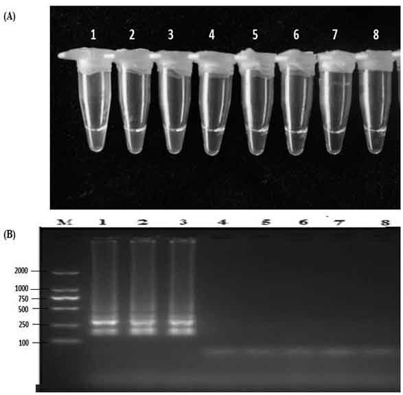 Loop-mediated amplification detection primer and detection method for potato early blight