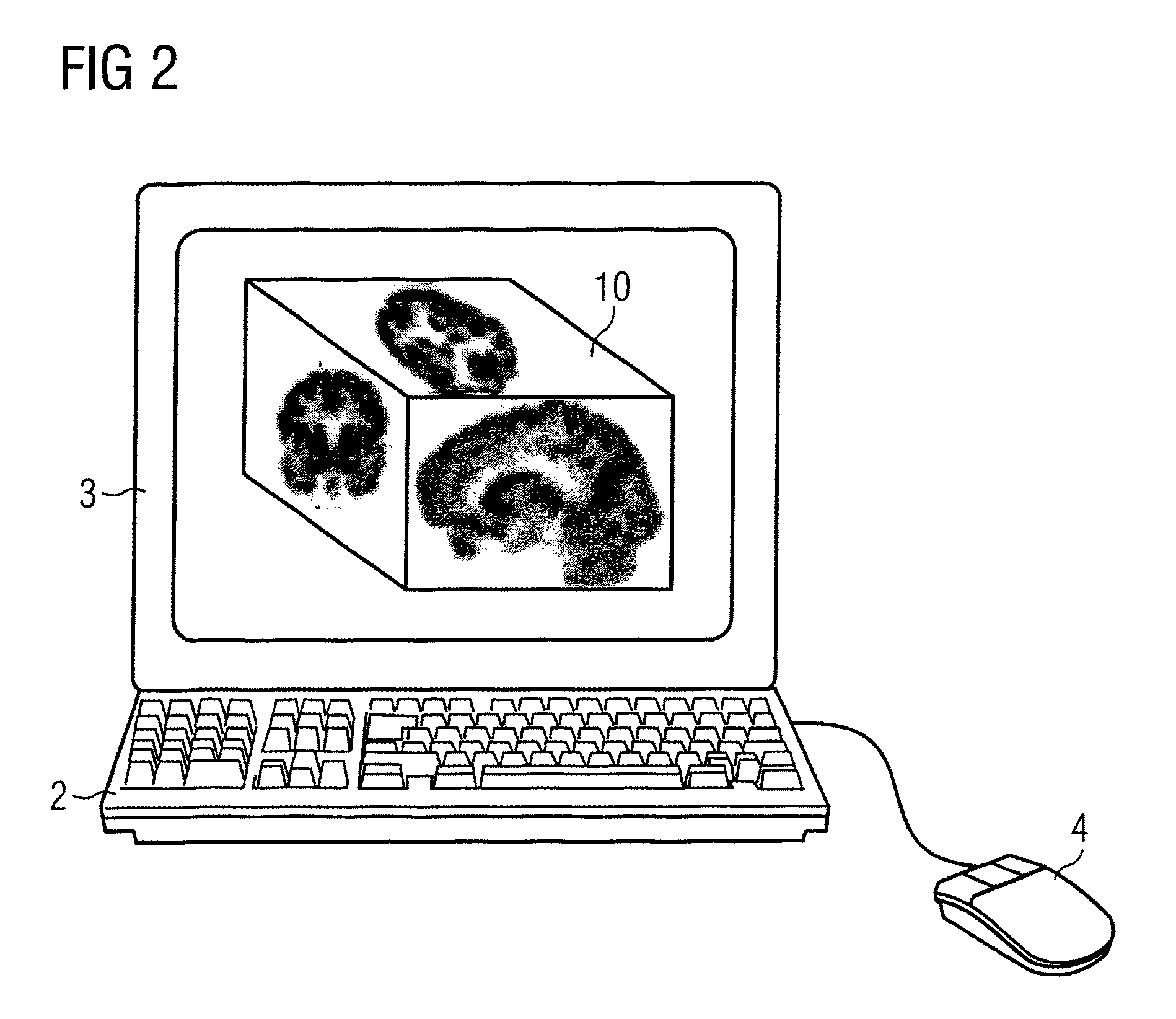 Method and user interface for the graphical presentation of medical data