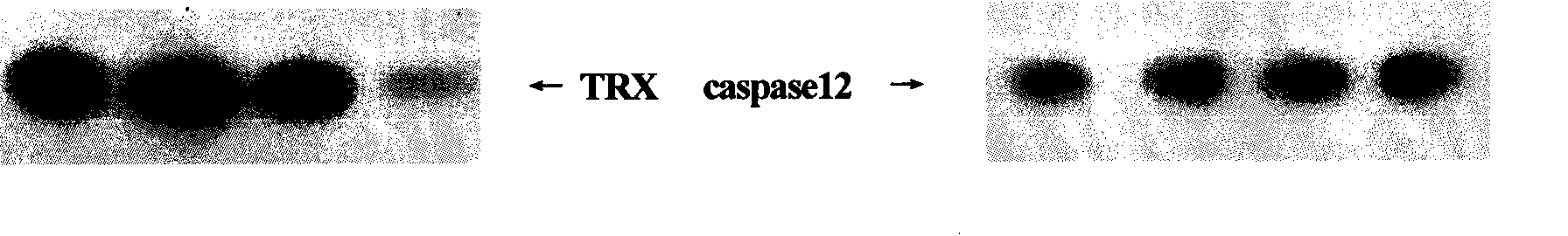 Method for simultaneously turning two films and marking protein TRX and procaspase12