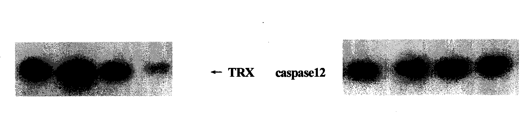 Method for simultaneously turning two films and marking protein TRX and procaspase12