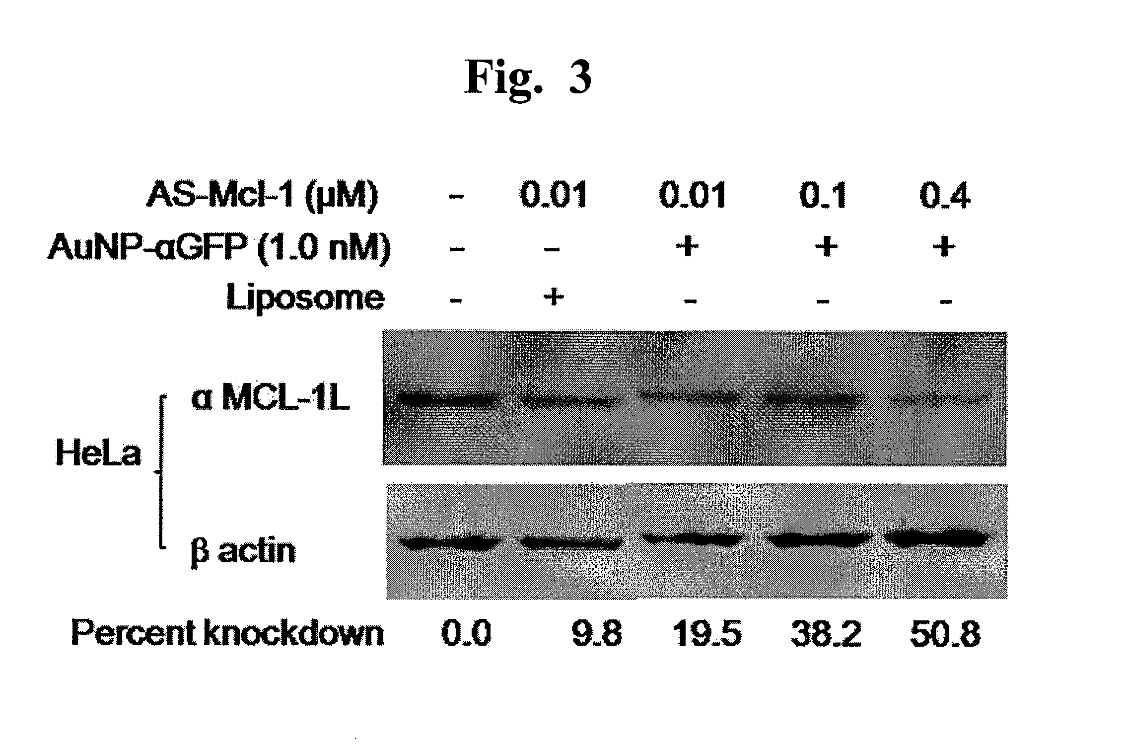 Nanoparticle-based gene delivery systems