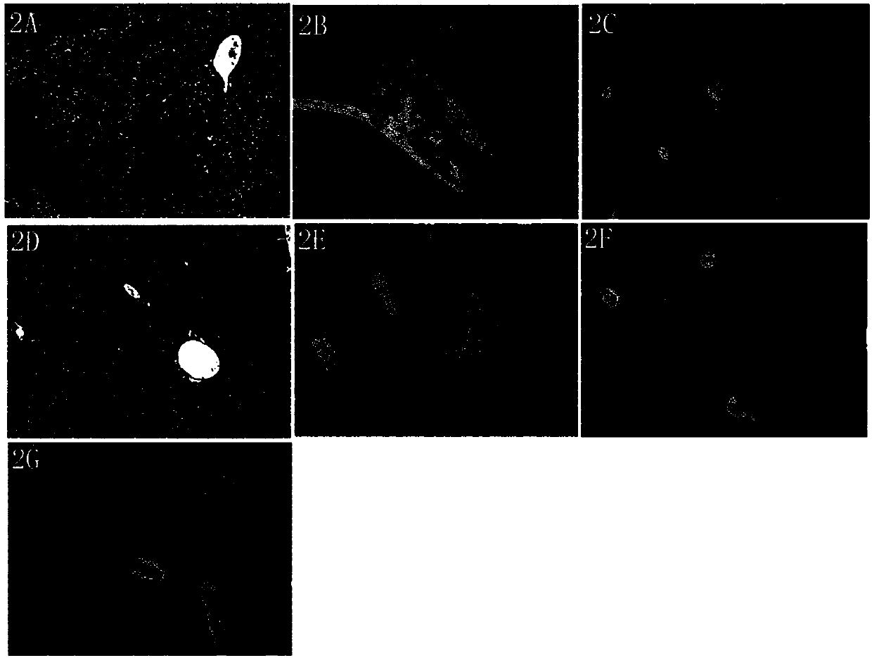 Drug for preventing and treating alcoholic liver disease