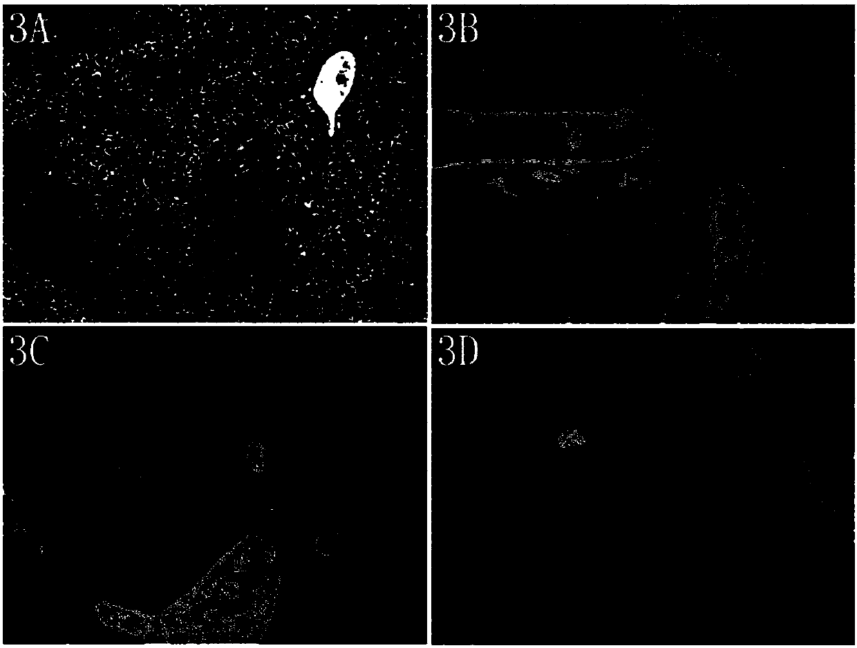 Drug for preventing and treating alcoholic liver disease