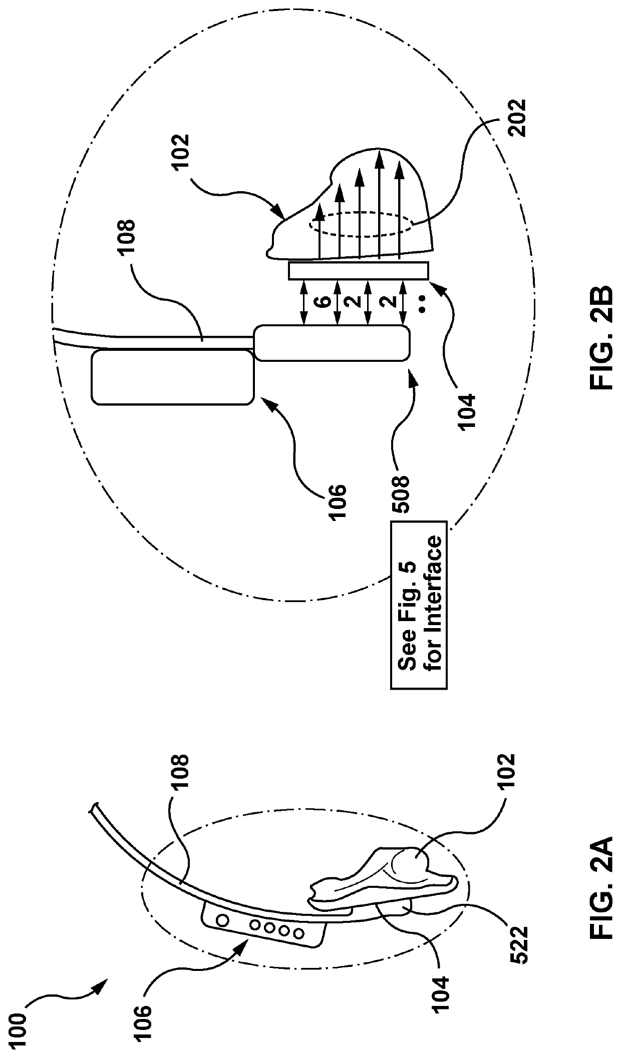 Devices, systems and methods for auricular acupuncture