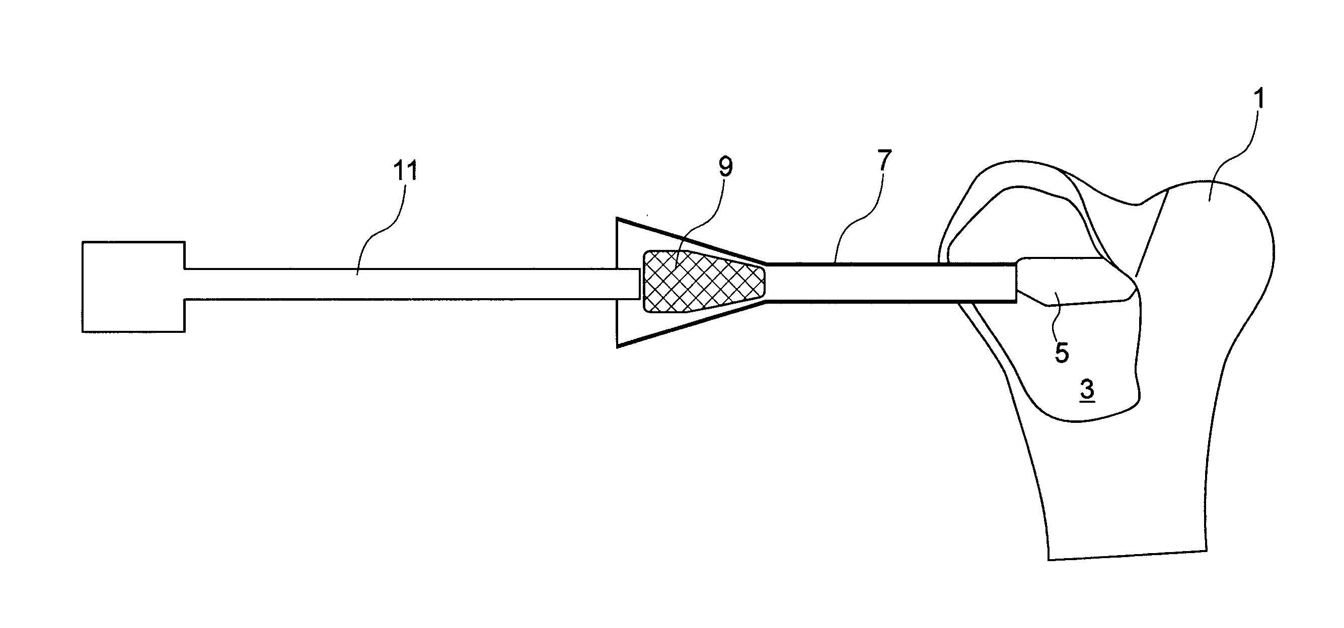 Synthetic bone substitute, method for preparing same and method for filing a cavity in a substrate