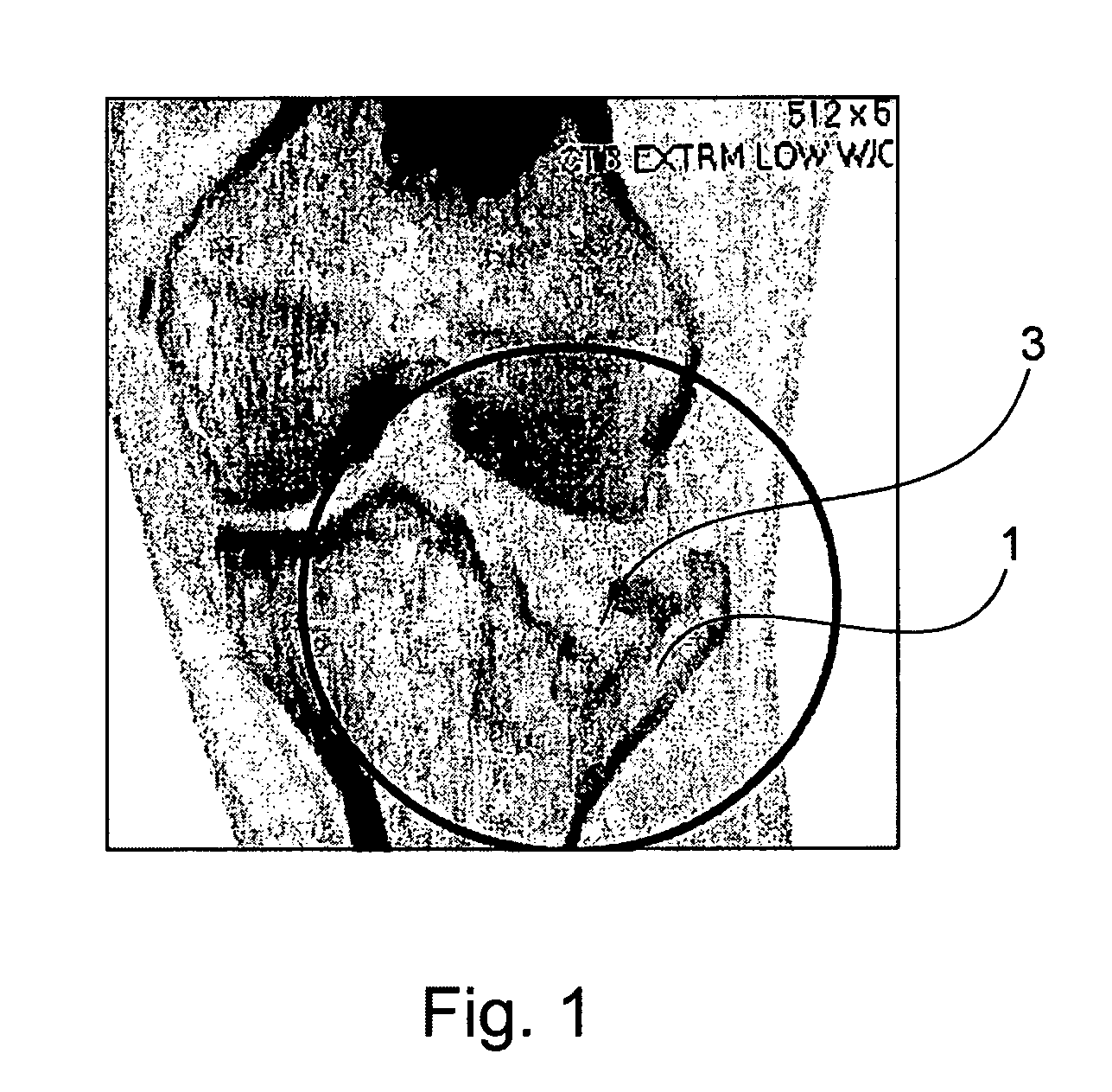 Synthetic bone substitute, method for preparing same and method for filing a cavity in a substrate