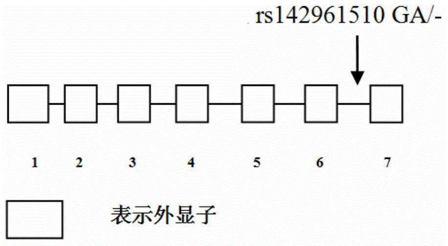 Kit for predicting curative effect of lucentis for treating age-related macular degeneration