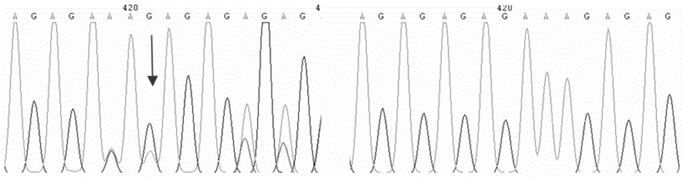 Kit for predicting curative effect of lucentis for treating age-related macular degeneration