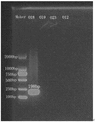 O18, O19, O23, and O12 specific nucleotides and applications