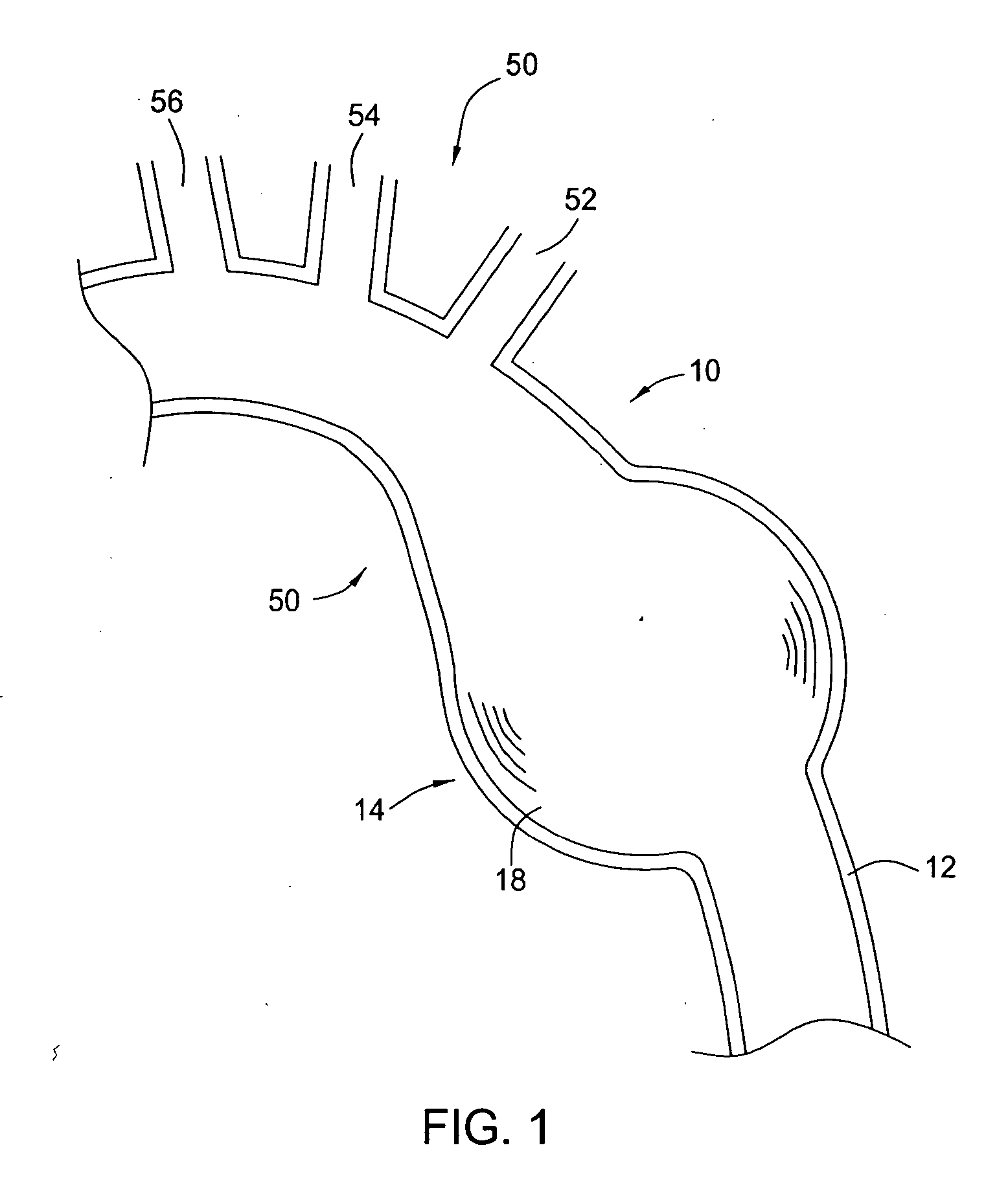 Methods and apparatus for treatment of aneurysms adjacent branch arteries