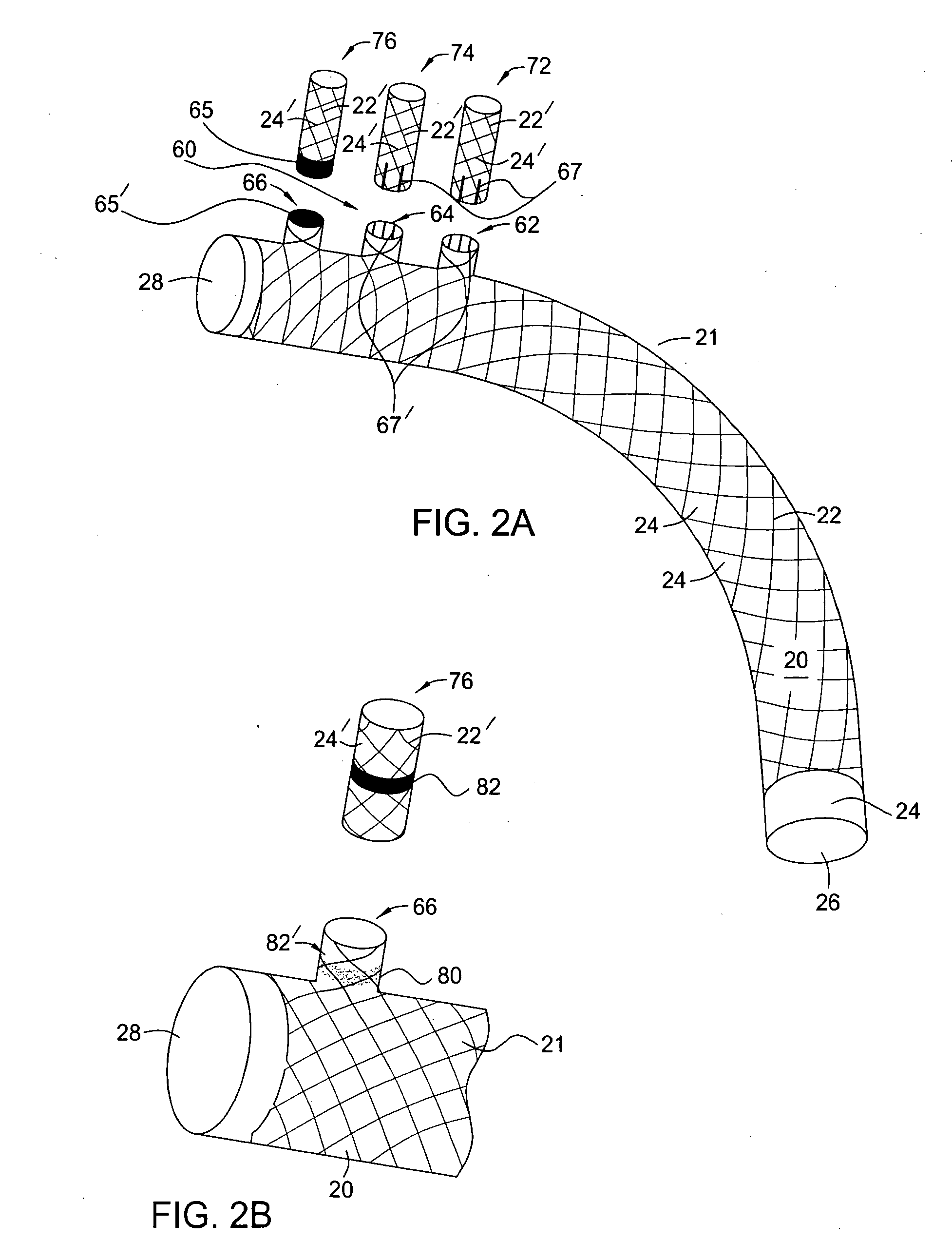 Methods and apparatus for treatment of aneurysms adjacent branch arteries