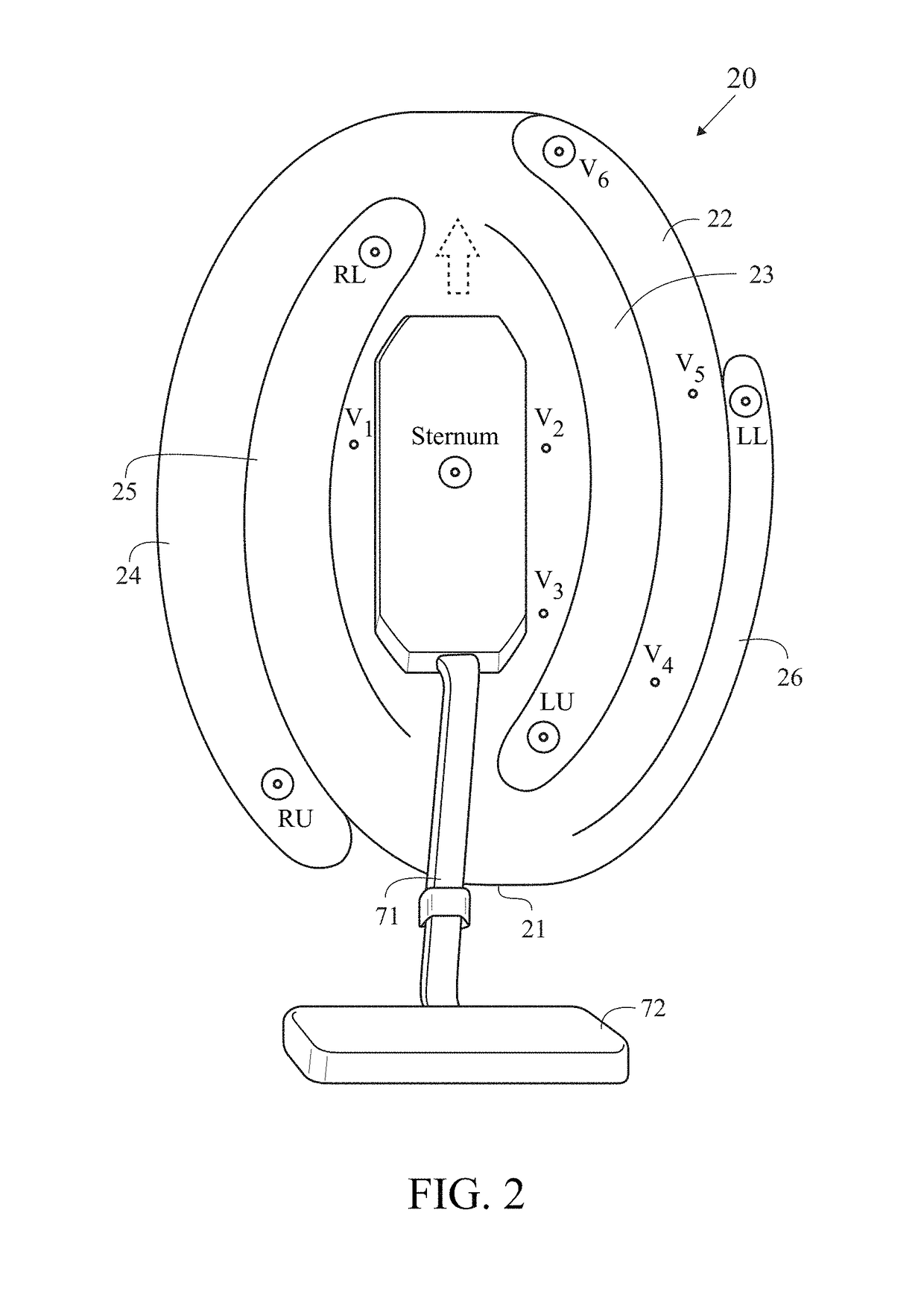 Emergency cardiac and electrocardiogram electrode placement system