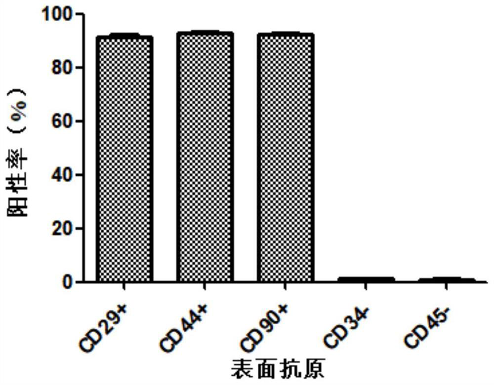 Preparation method of human adipose tissue-derived stromal cell exosome with high expression of IL-10 for treating myocardial infarction