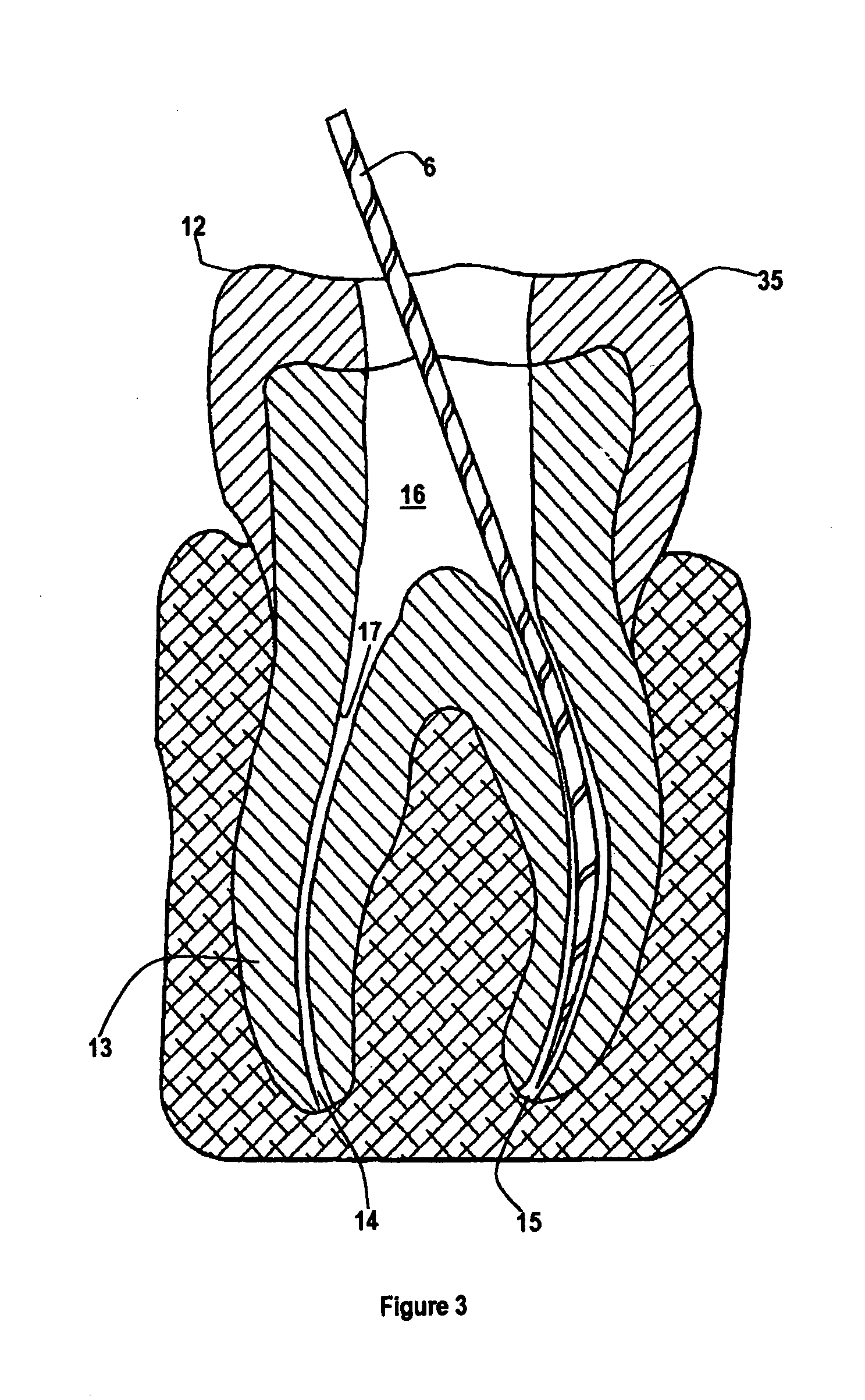 Rotary dental file having a safe breakage point