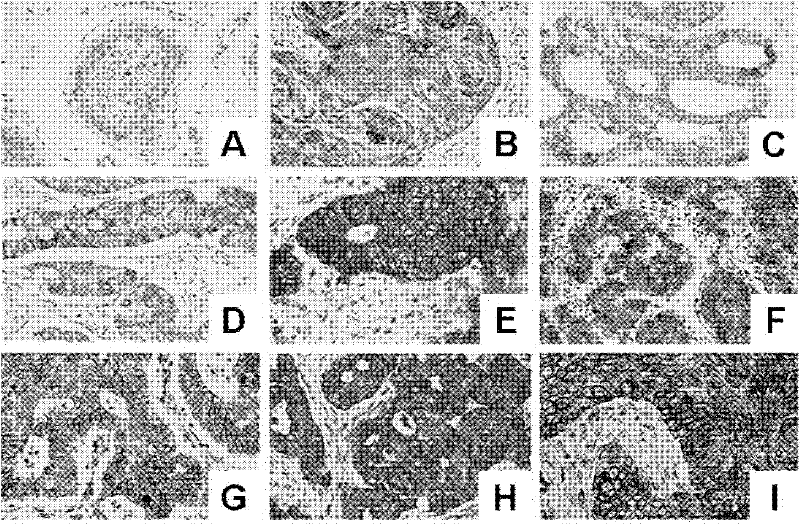 Method for screening and identifying tumor/testis antigens based on monoclonal antibodies with spermatogenic cell specificities