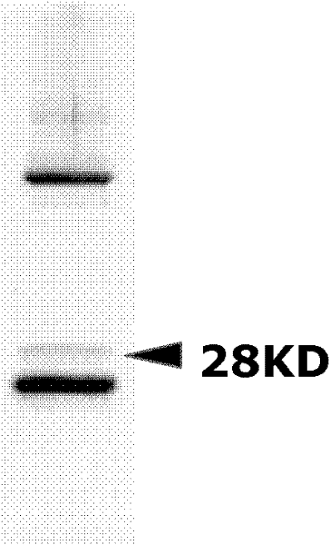 Method for screening and identifying tumor/testis antigens based on monoclonal antibodies with spermatogenic cell specificities