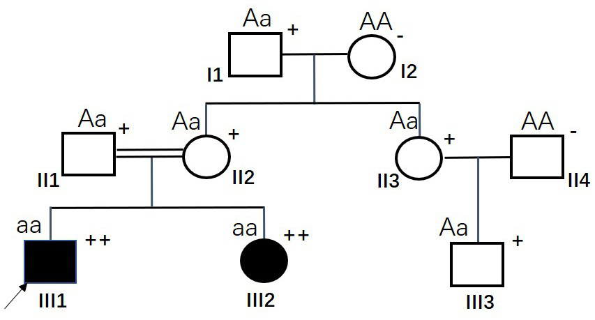 A msh6 gene mutated at the 12907th point and its application