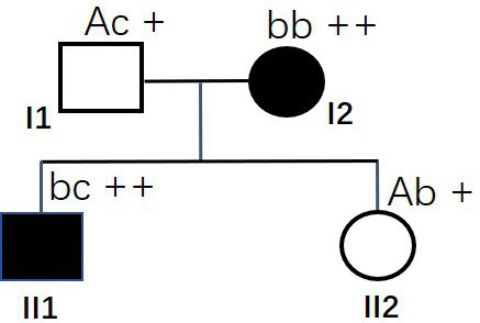 A msh6 gene mutated at the 12907th point and its application