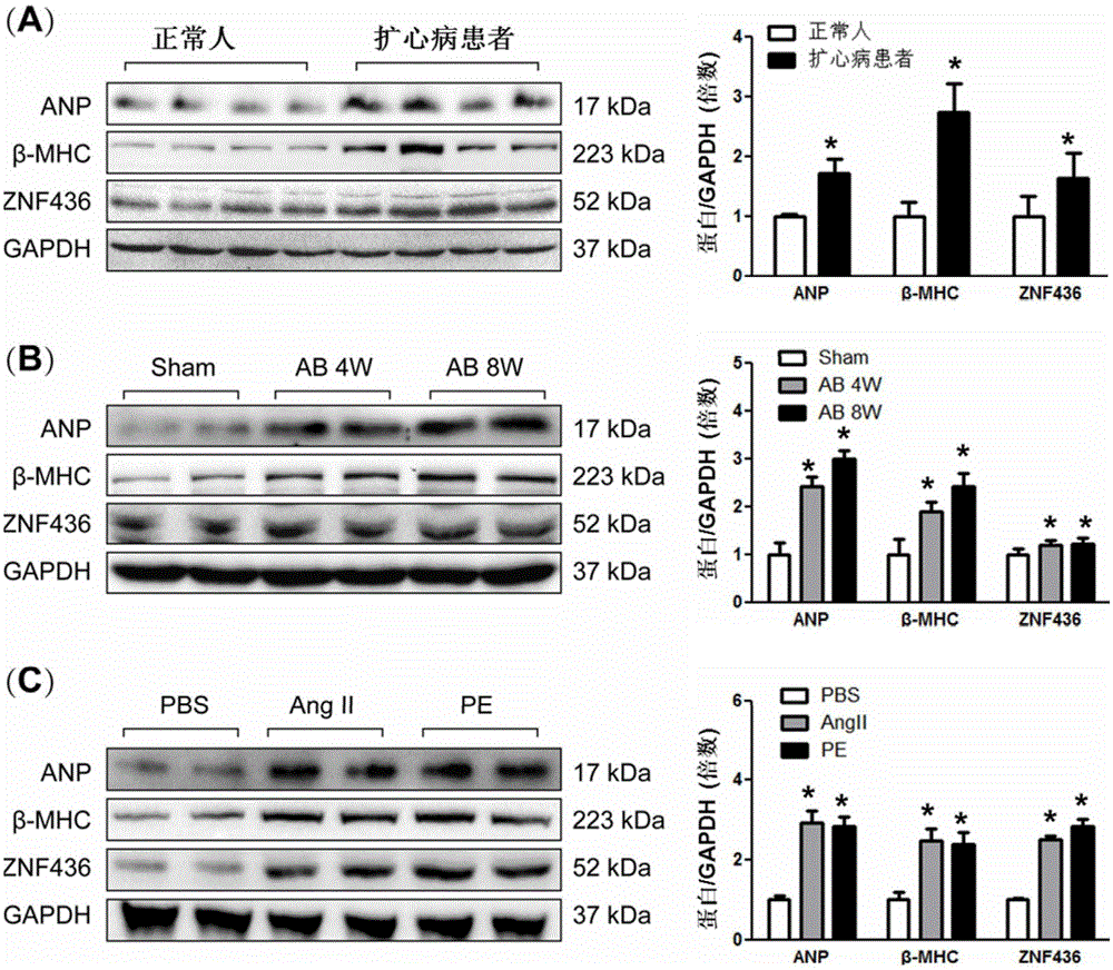 Application of zinc finger protein 436 (ZNF 436) to treatment of myocardial hypertrophy