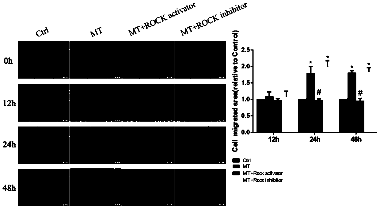 Application of melatonin in preparation of medicine for treating and adjunctively treating osteosarcoma