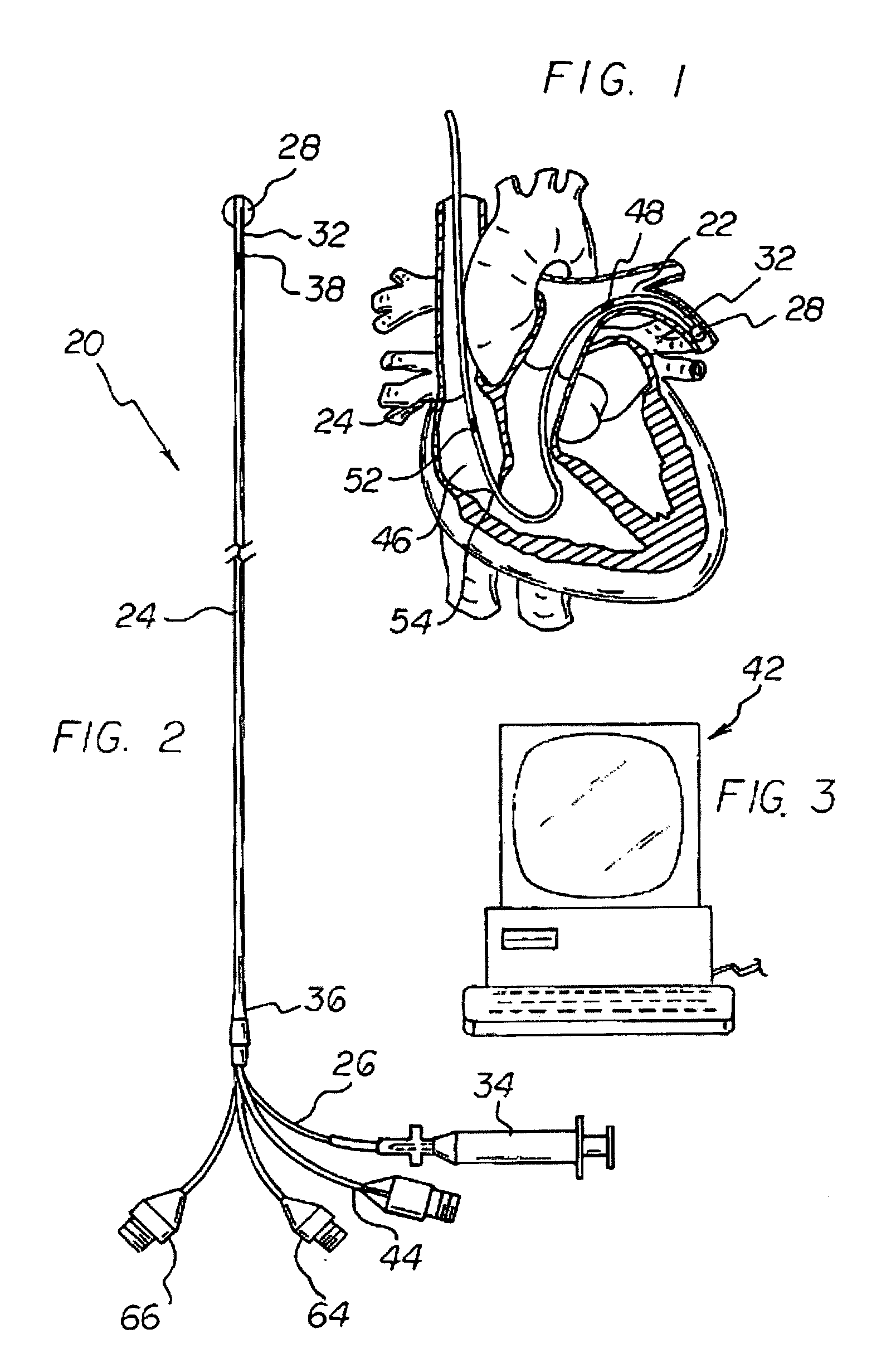 Apparatus and method for measuring myocardial oxygen consumption