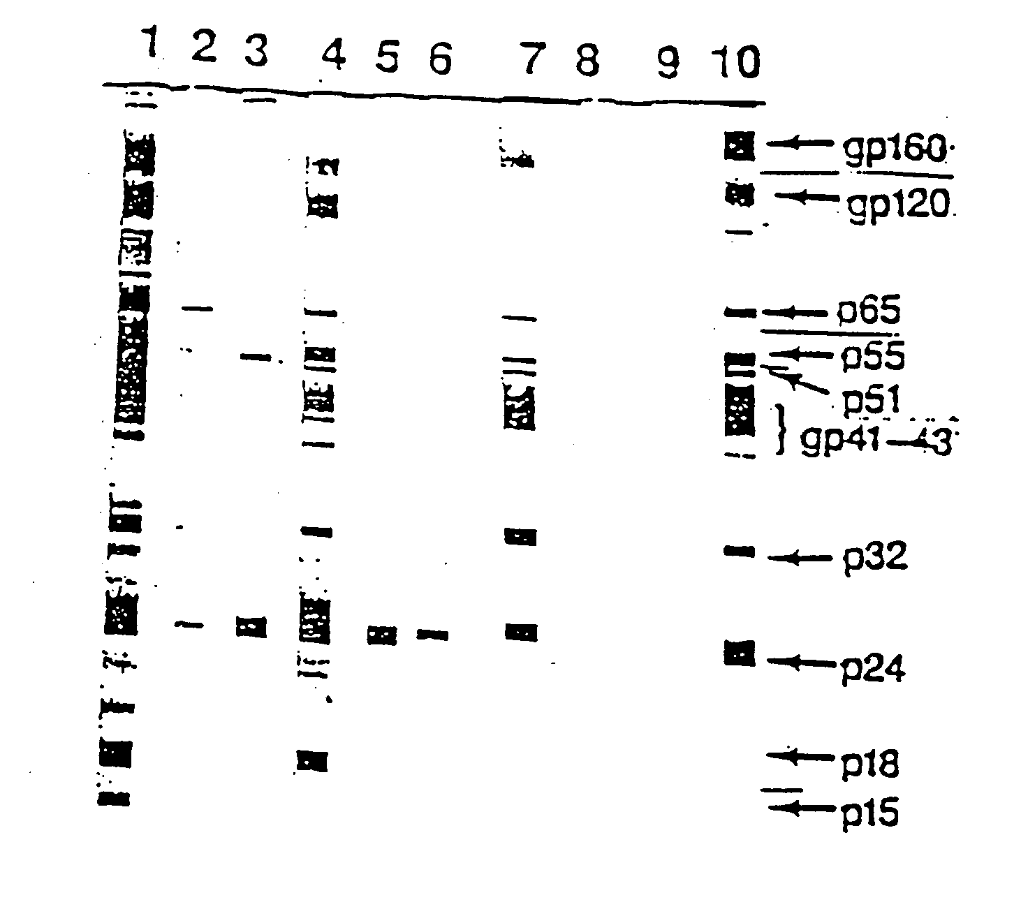 Anti-idiotypic antibody and its use in diagnosis and therapy in HIV-related disease