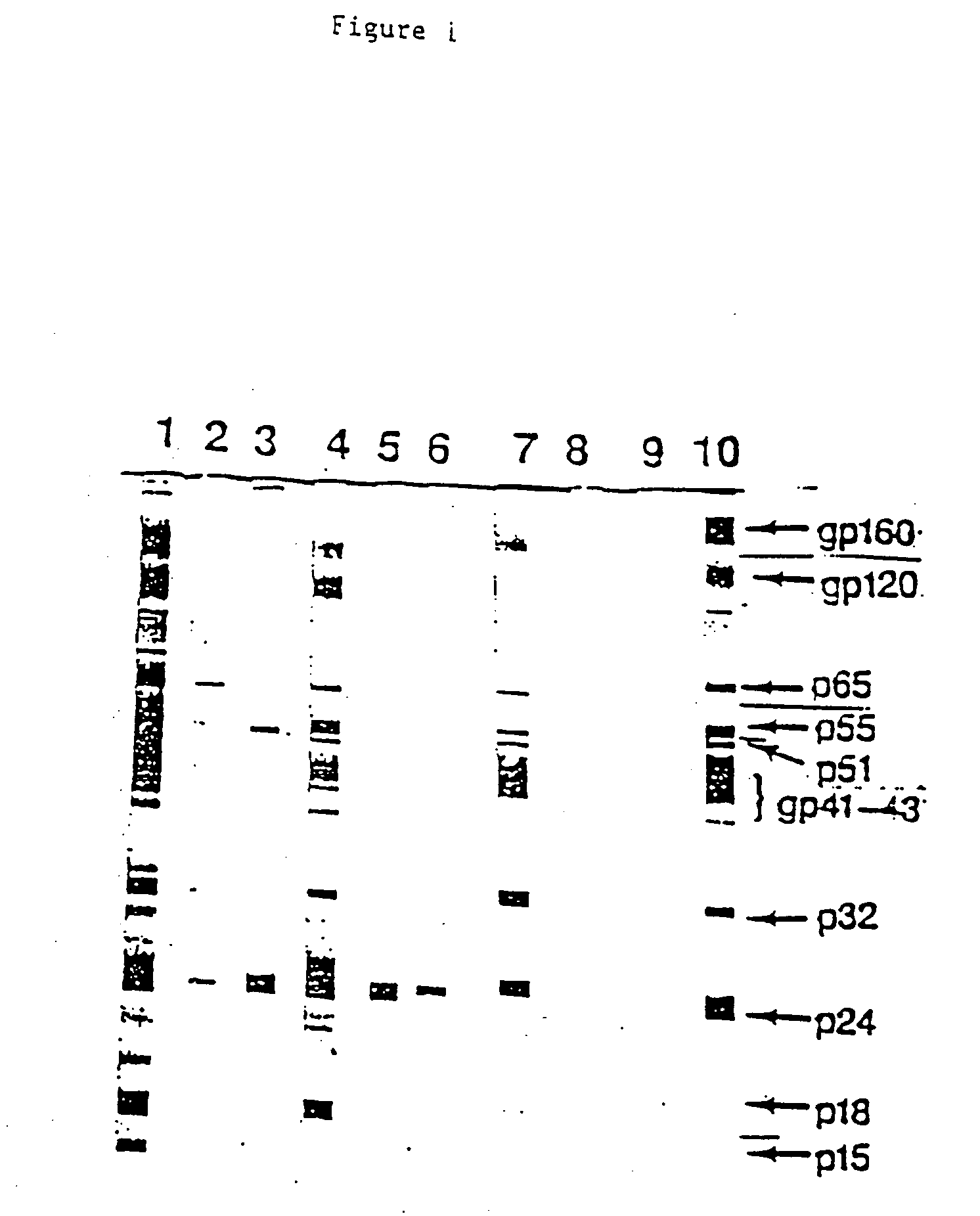 Anti-idiotypic antibody and its use in diagnosis and therapy in HIV-related disease