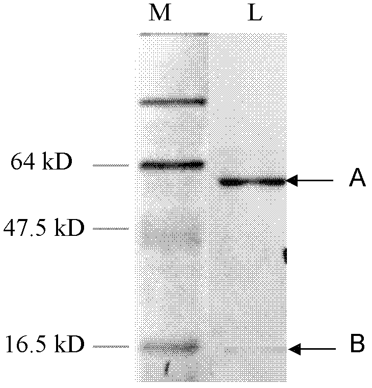 Carboxyl-terminal specific anti-human amyloid protein monoclonal antibody gene and its encoded polypeptide and application