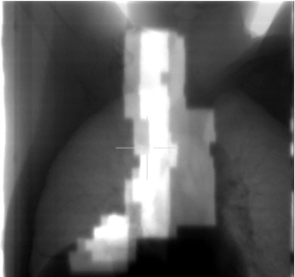 Shooting and Verification Method of Intensity Modulated Radiation Field Confirmation Film